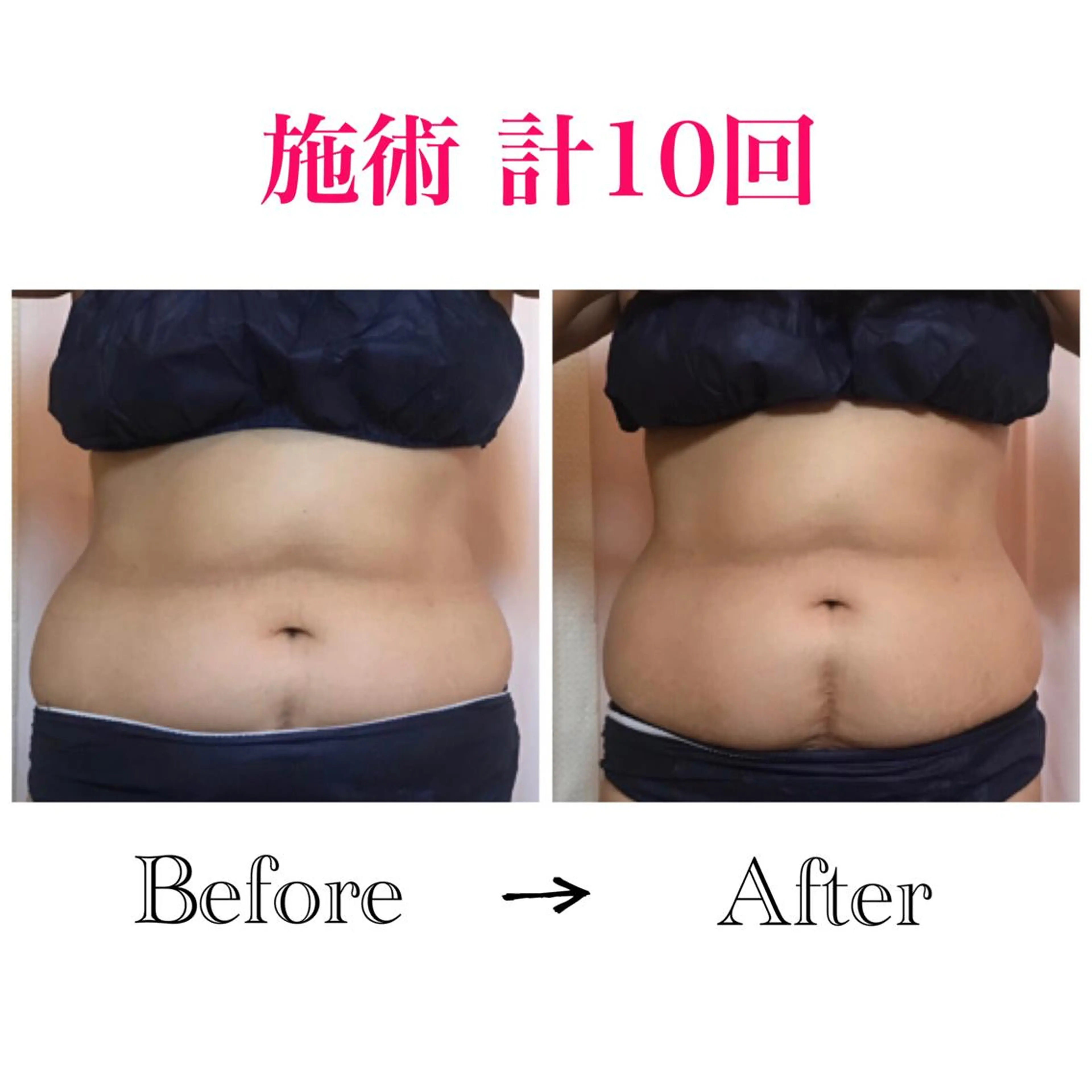 &. BYのエステ・リラクイメージ