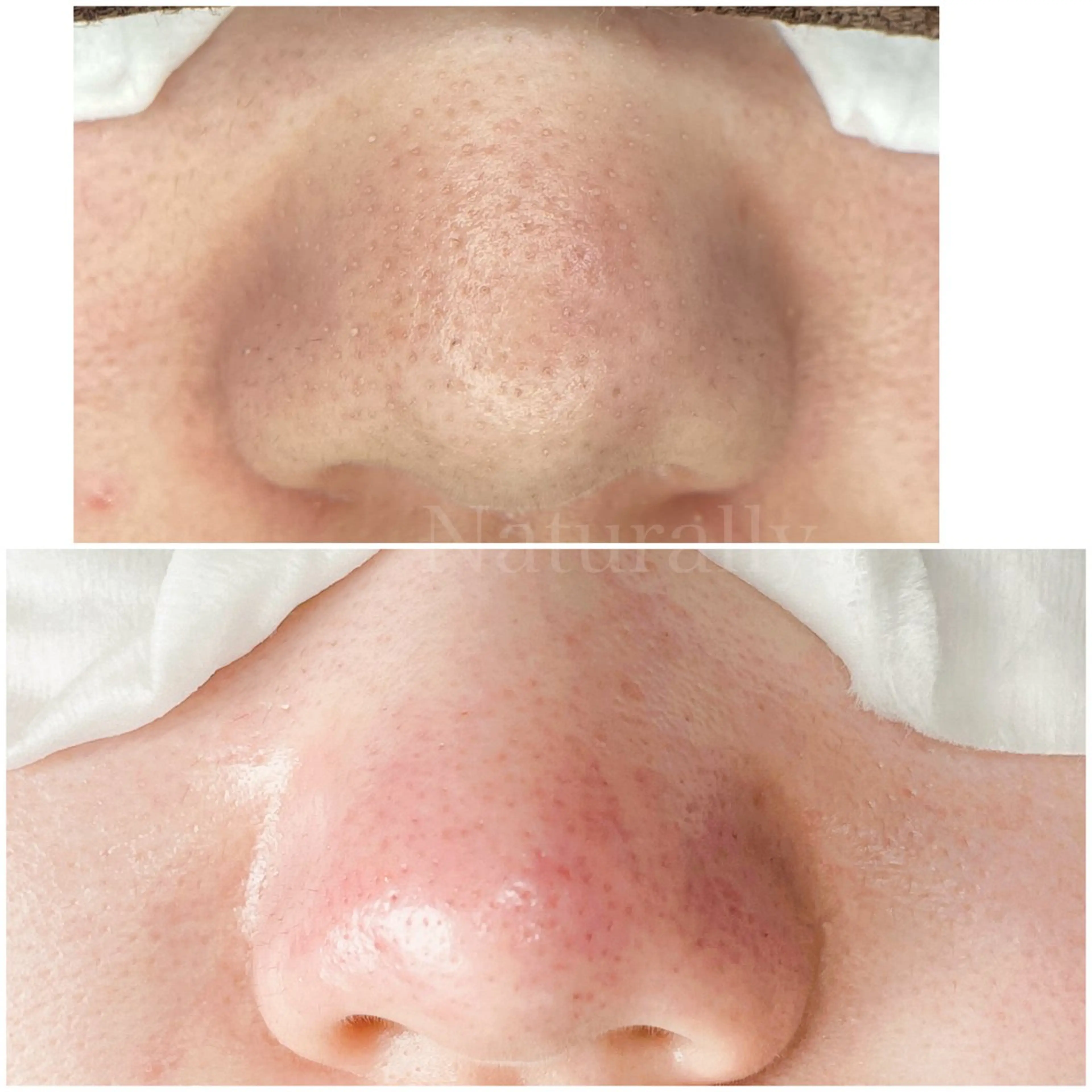 Naturally ナチュラリーのマツエク・マツパデザイン