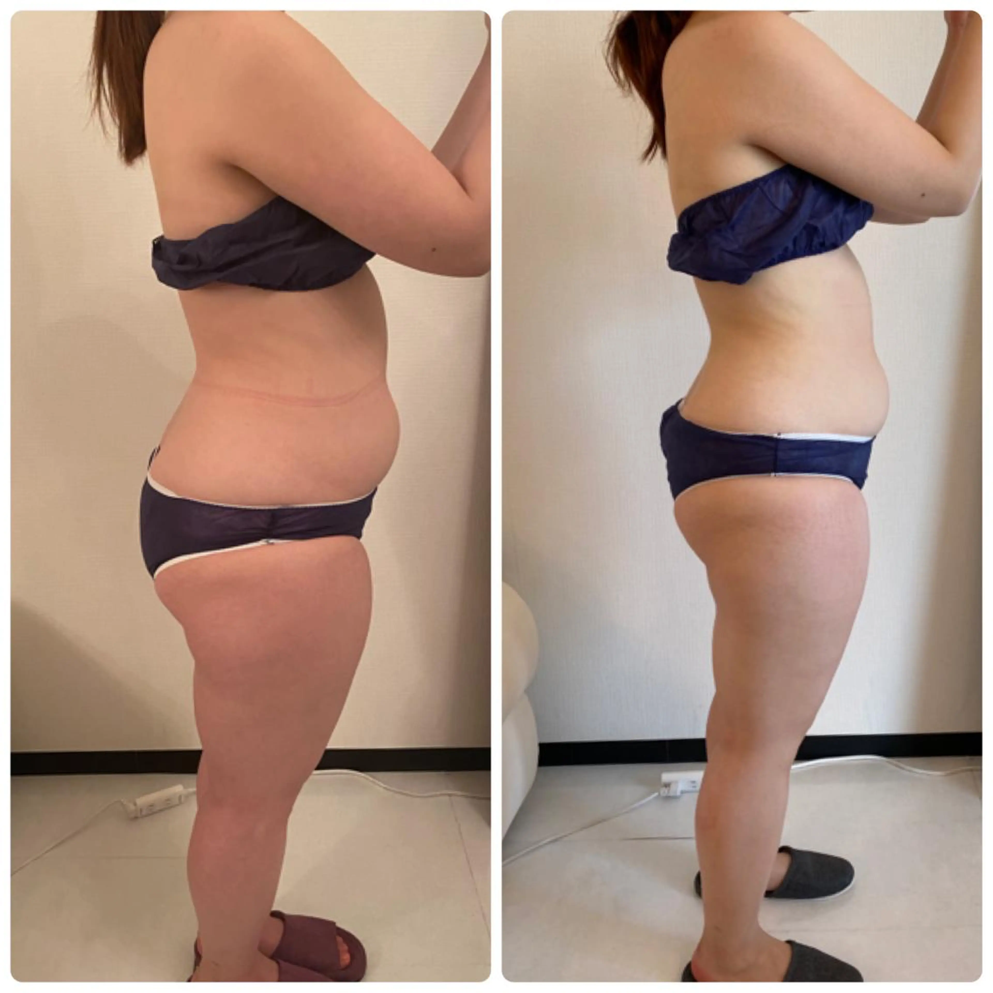 FLEUR大阪・美容 整体・痩身・小顔のエステ・リラクイメージ