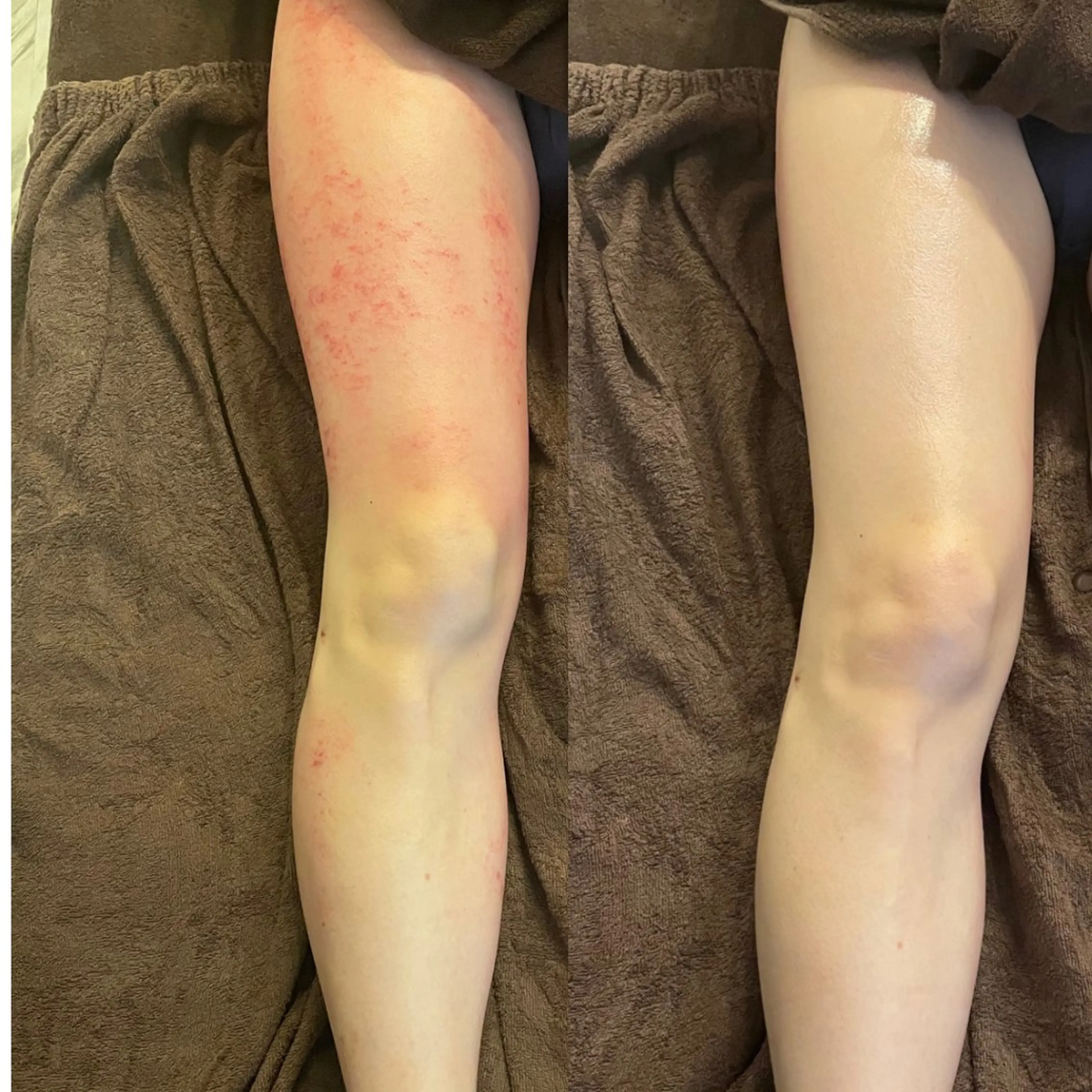 セルフエステエンリケ明石大久保店所属・夕希リンパ&痩身& 脱毛&毛穴ケアのエステ・リラクイメージ