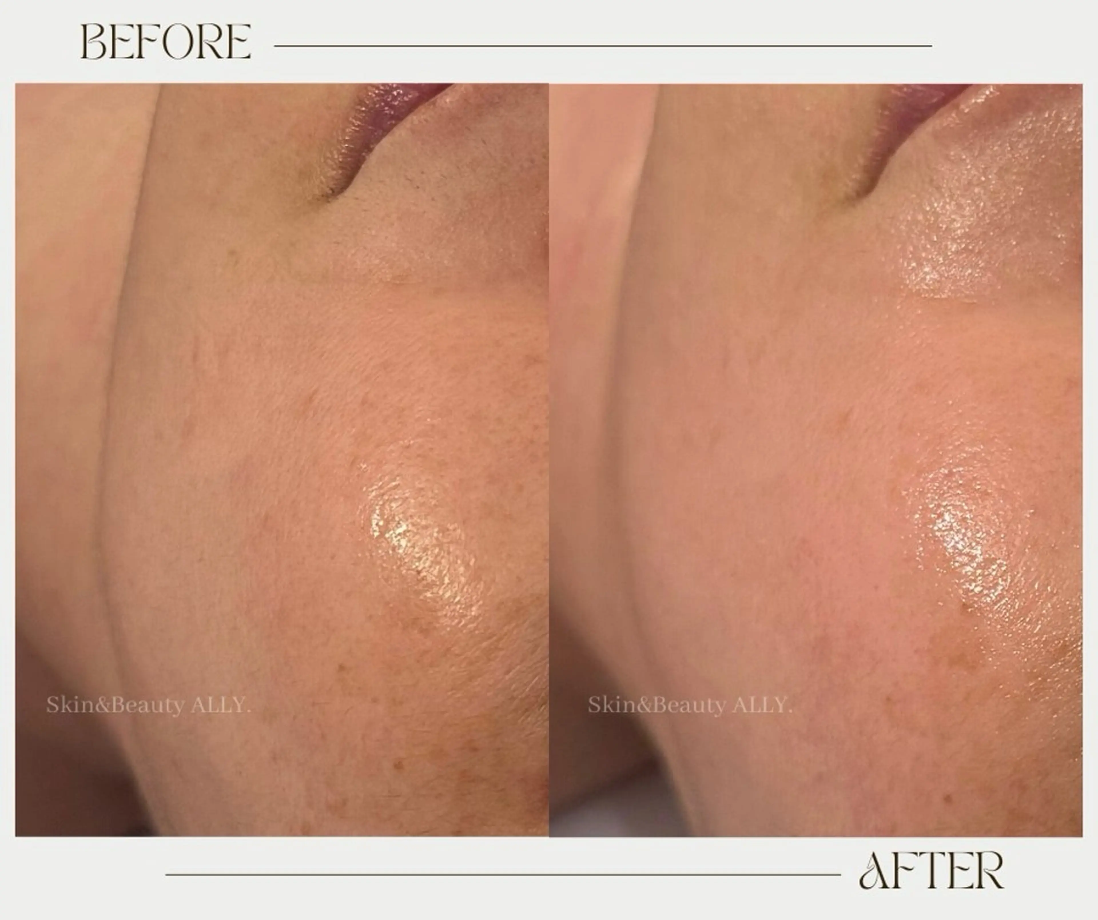 エステ 艶肌ワックス ALLY.のエステ・リラクイメージ