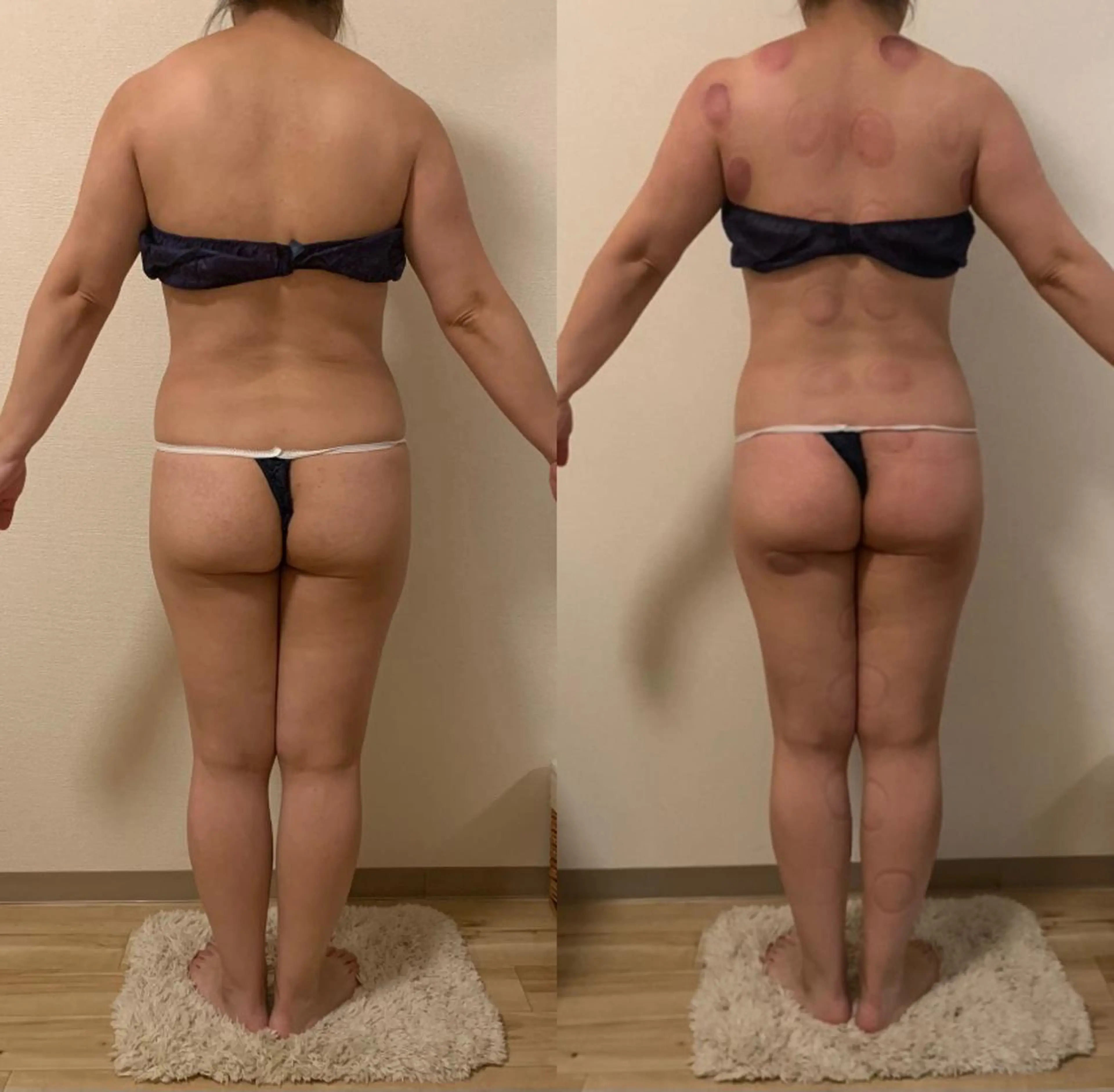 a  room salonのエステ・リラクイメージ