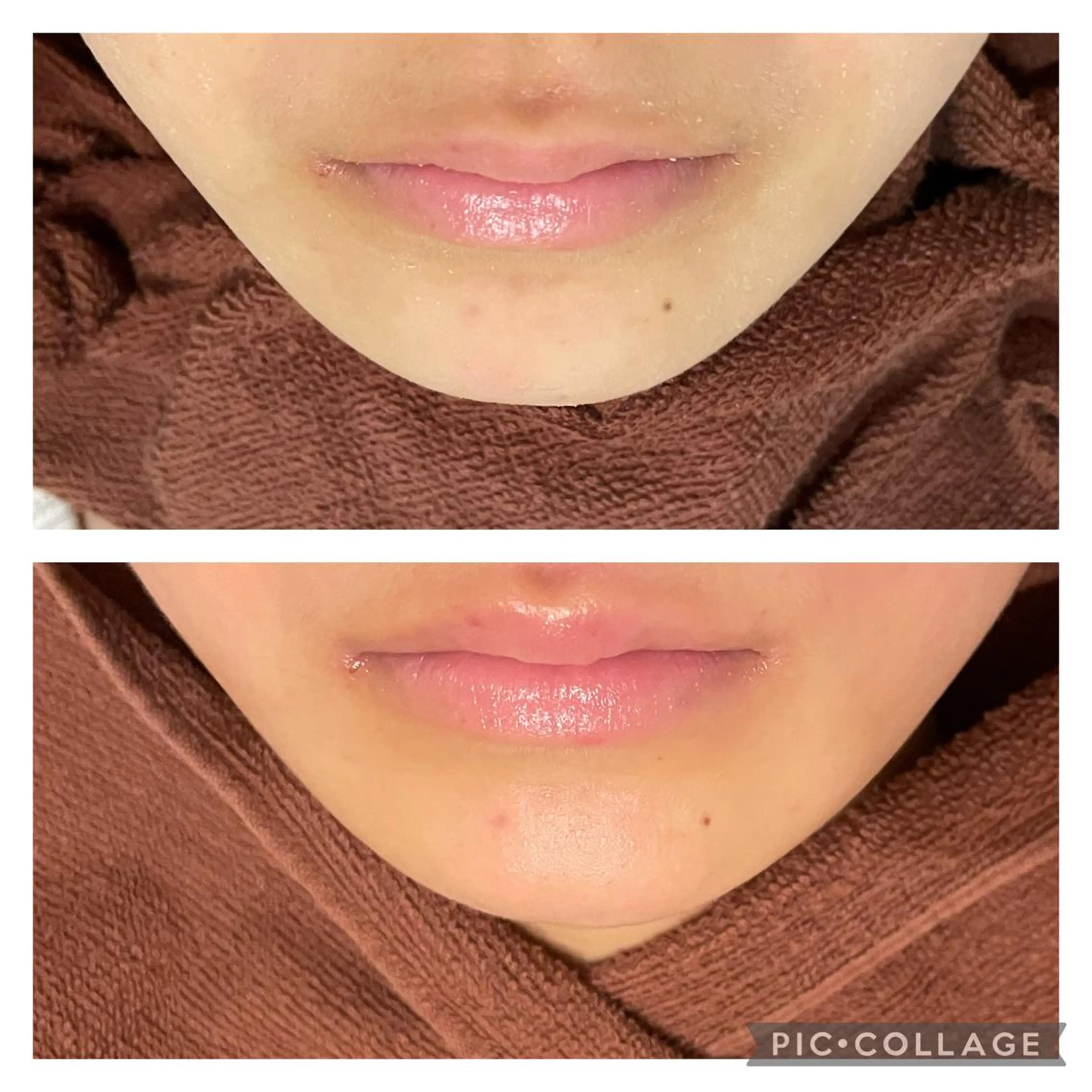 セミロング カラー パーマ ヘアアレンジ メンズ キッズ ネイル マツエク・マツパ アイブロウ エステ リラク ニキビ特化型エステ 🍓最短で肌質改善のエステ・リラクイメージ