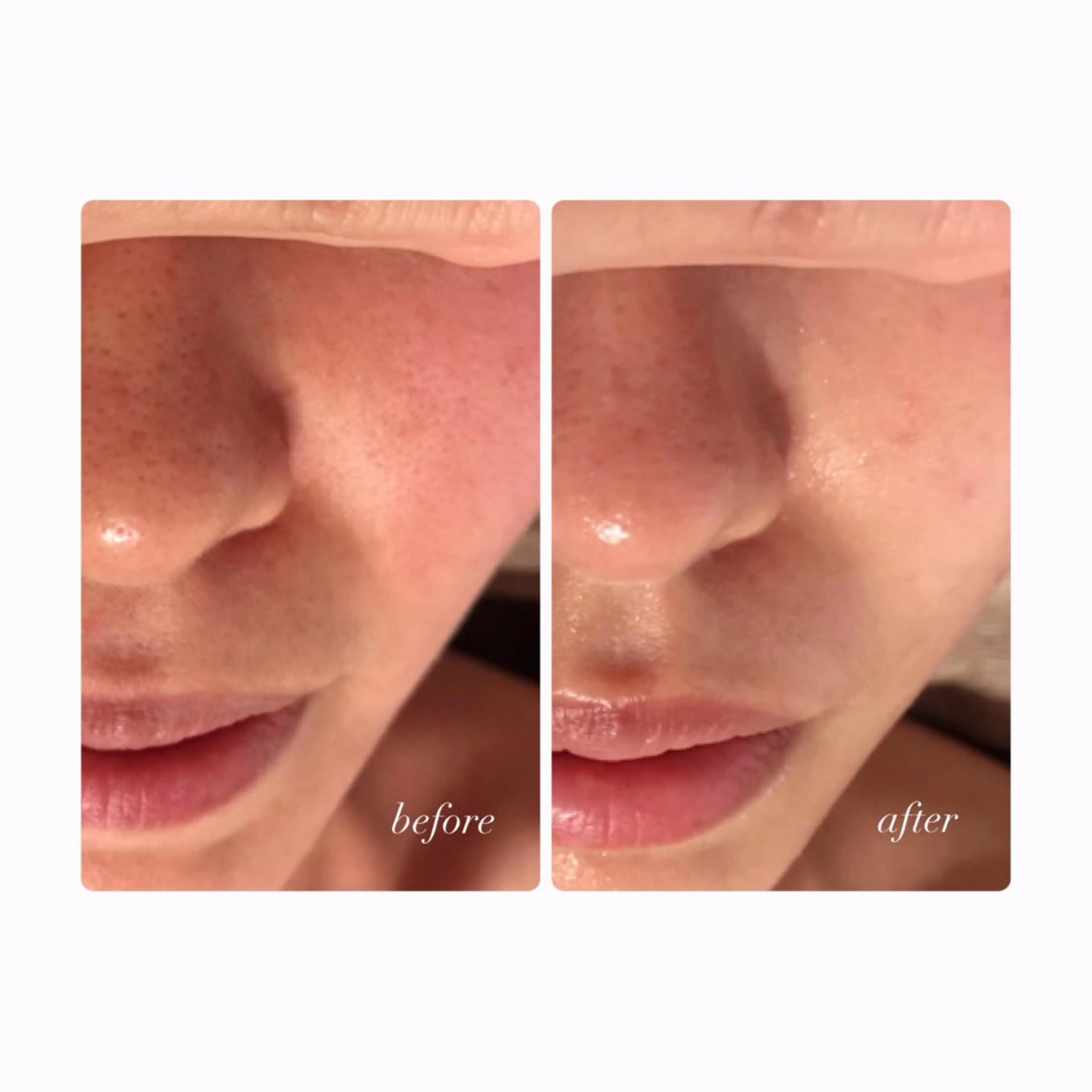 エステ リラク private salon hanaのエステ・リラクイメージ