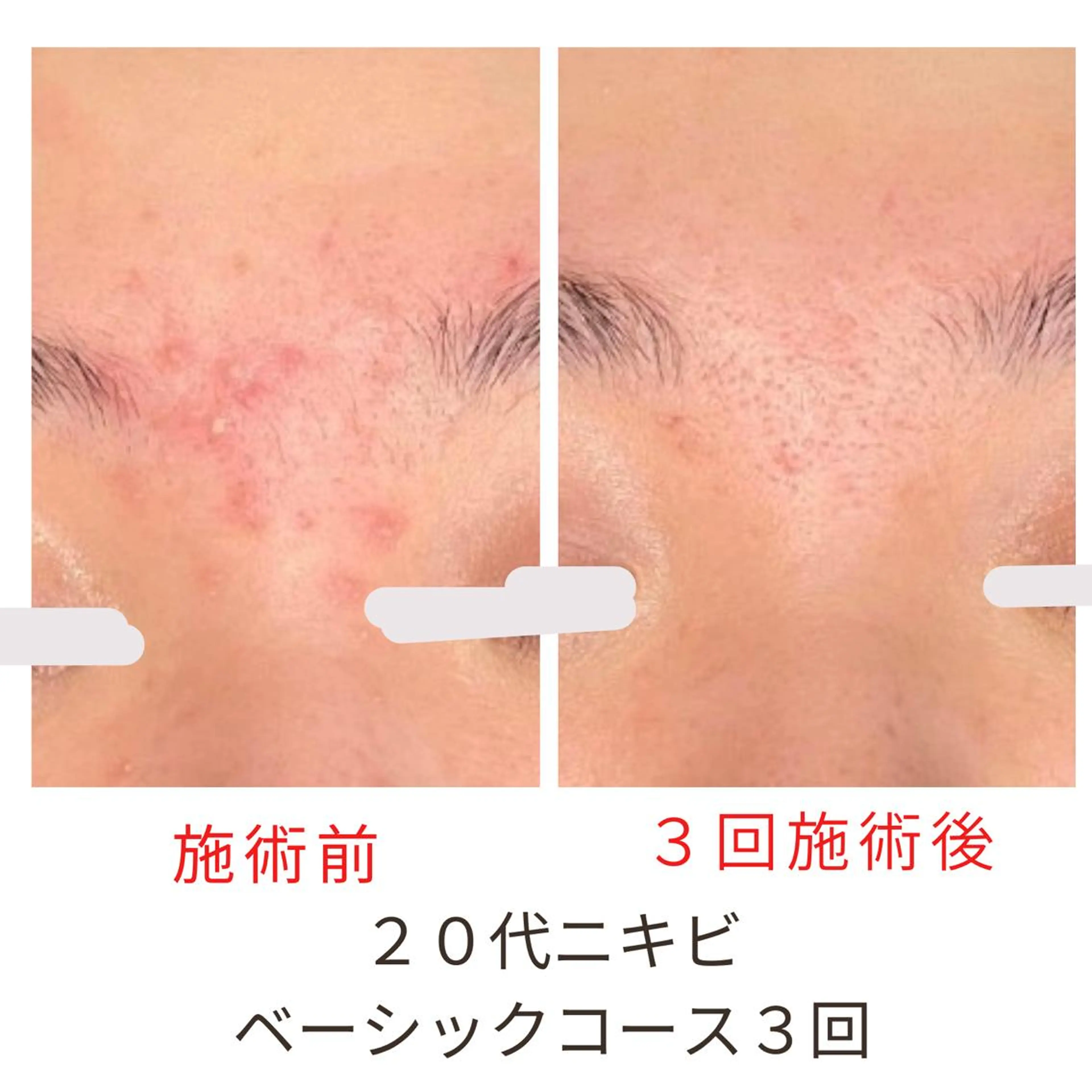 エステ ベラージュ【美背中・ 美尻・フェイシャル】のエステ・リラクイメージ