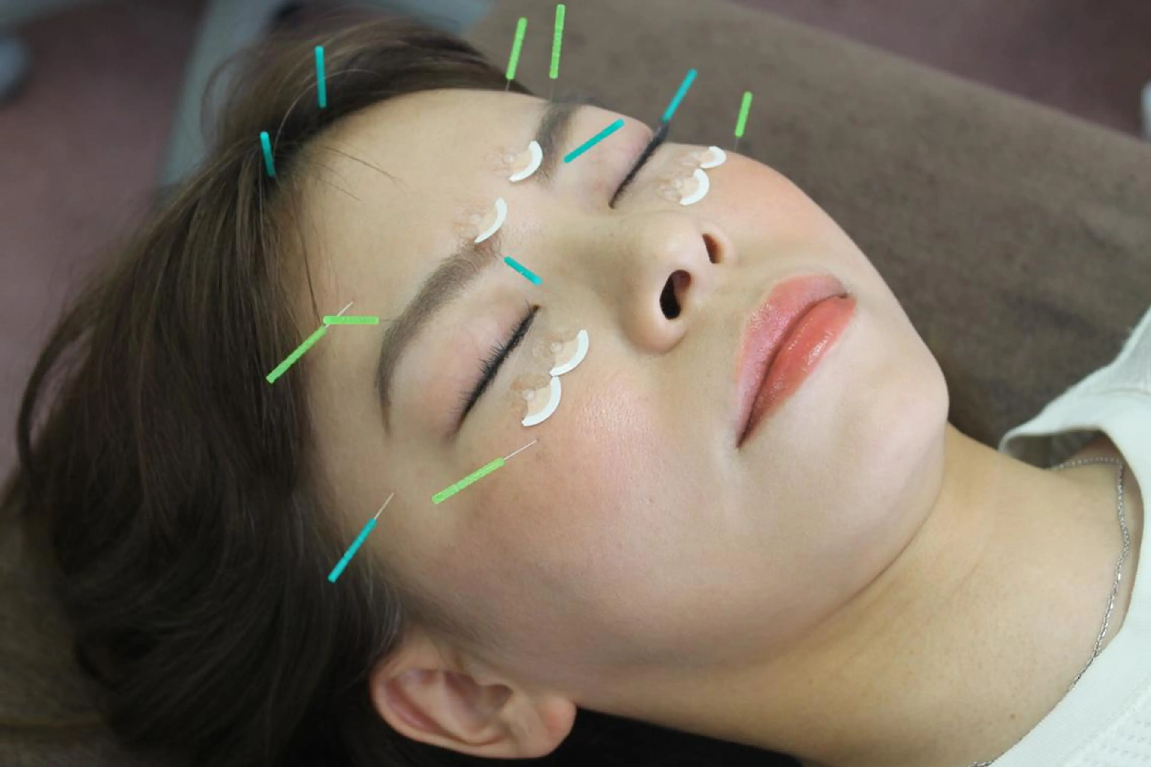 エステ 同心整骨院 美容鍼・整体・小顔のエステ・リラクイメージ