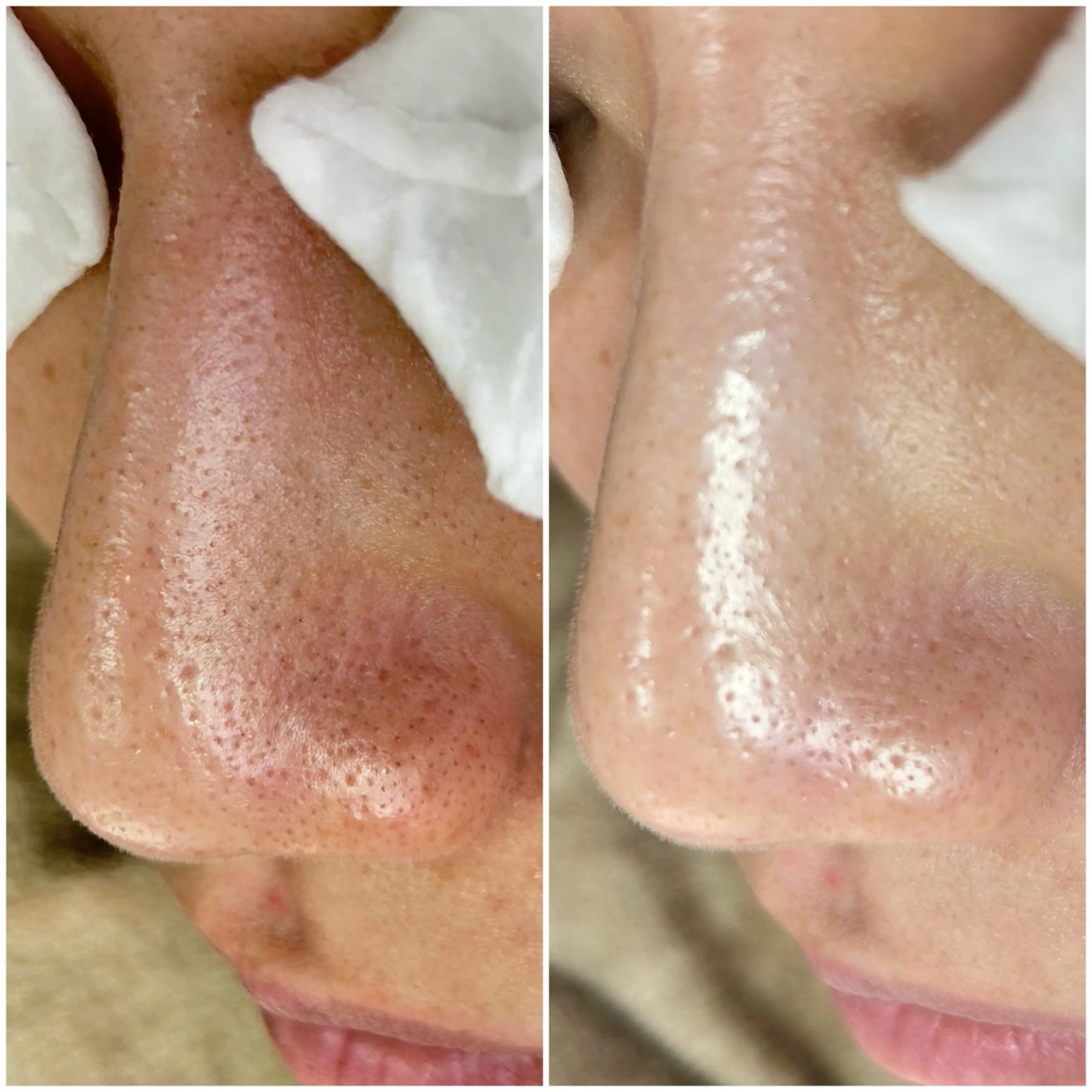 エステ 毛穴洗浄専門店/ 泉佐野/oluoluのエステ・リラクイメージ