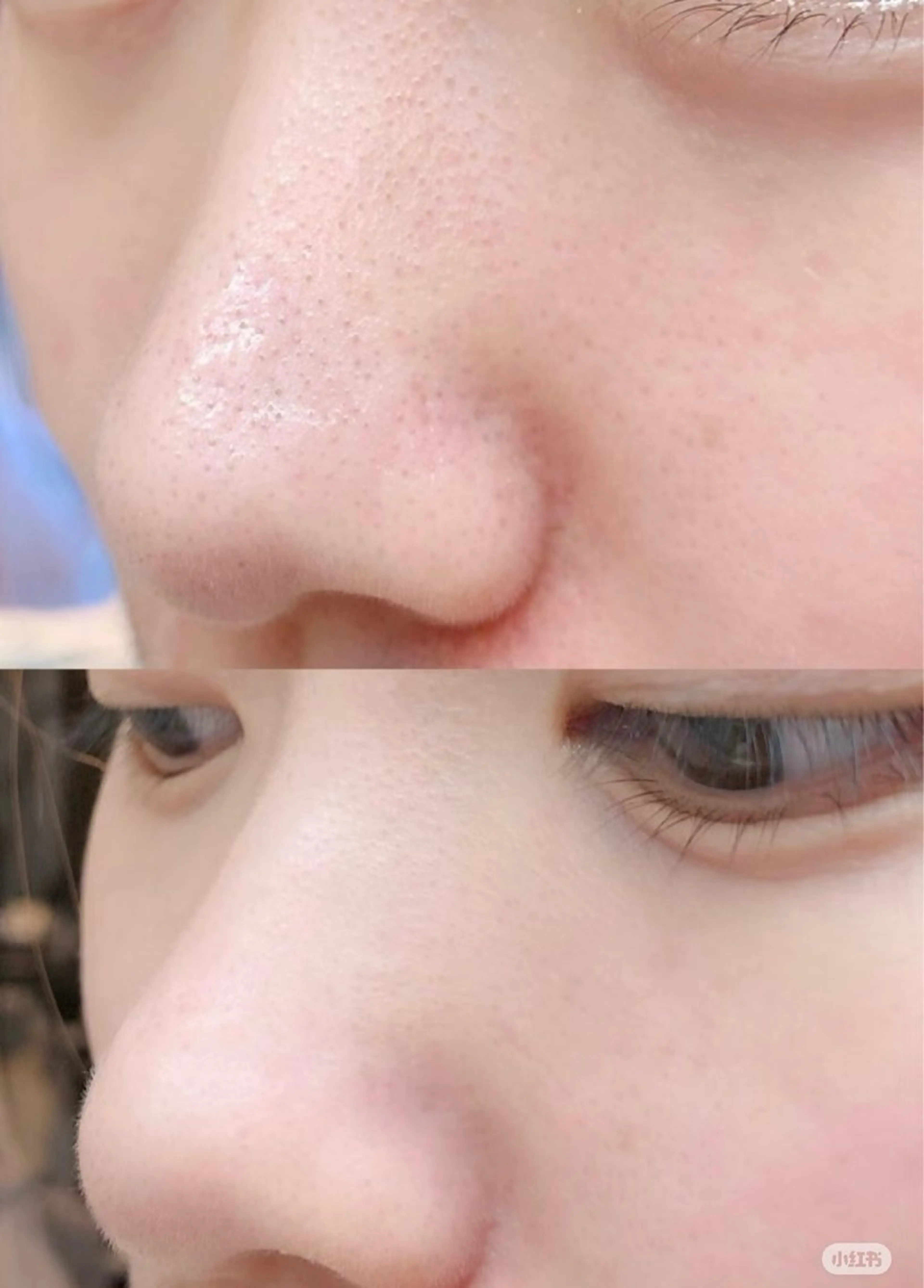 マツエク・マツパ エステ aliaハイフ&水光ジェットサロン所属・aliaハーブ水光店 エステティシャン募集のエステ・リラクイメージ