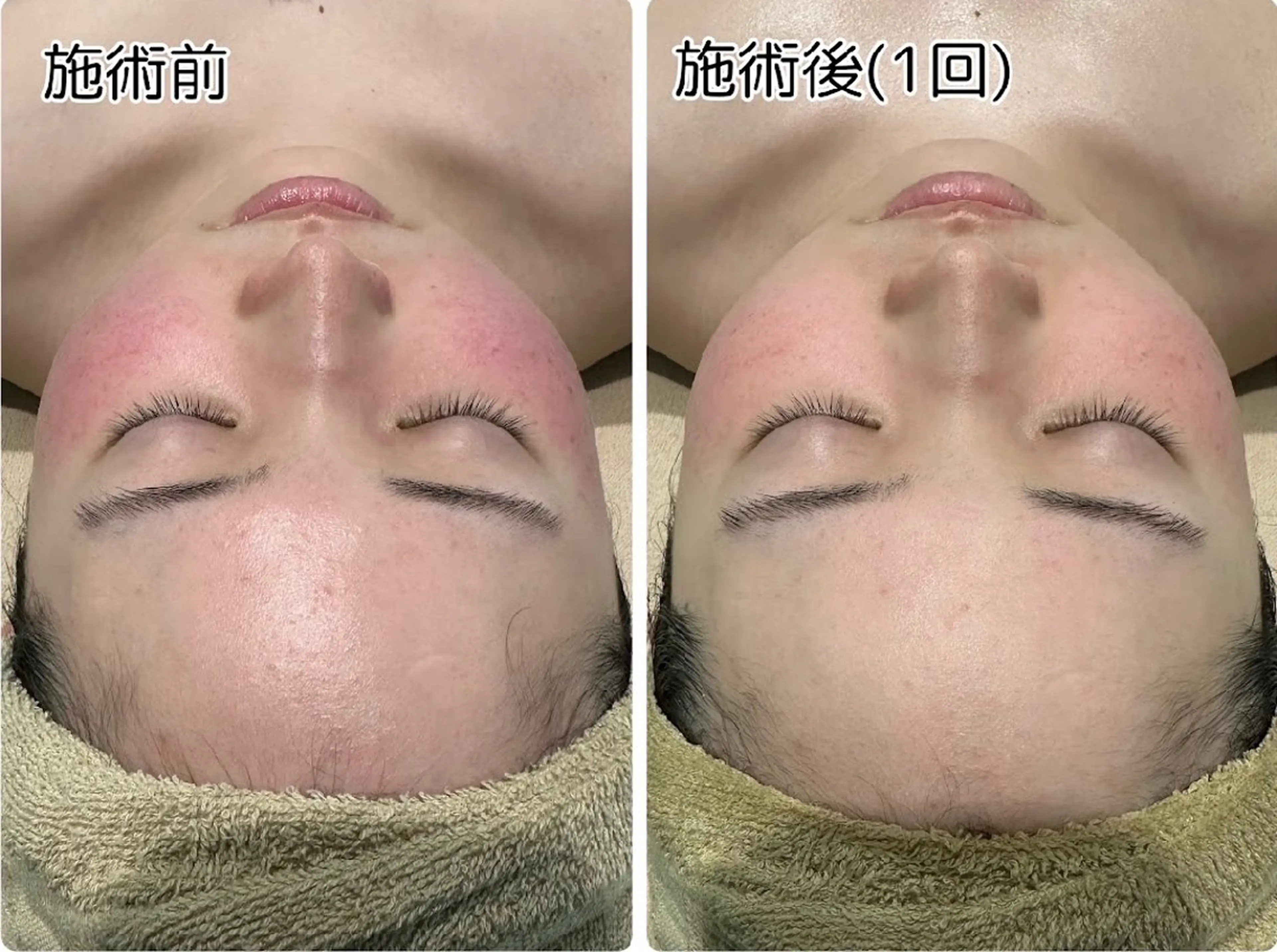 フットネイル LOUISE.所属・LOUISE. ／ネイルのネイルデザイン