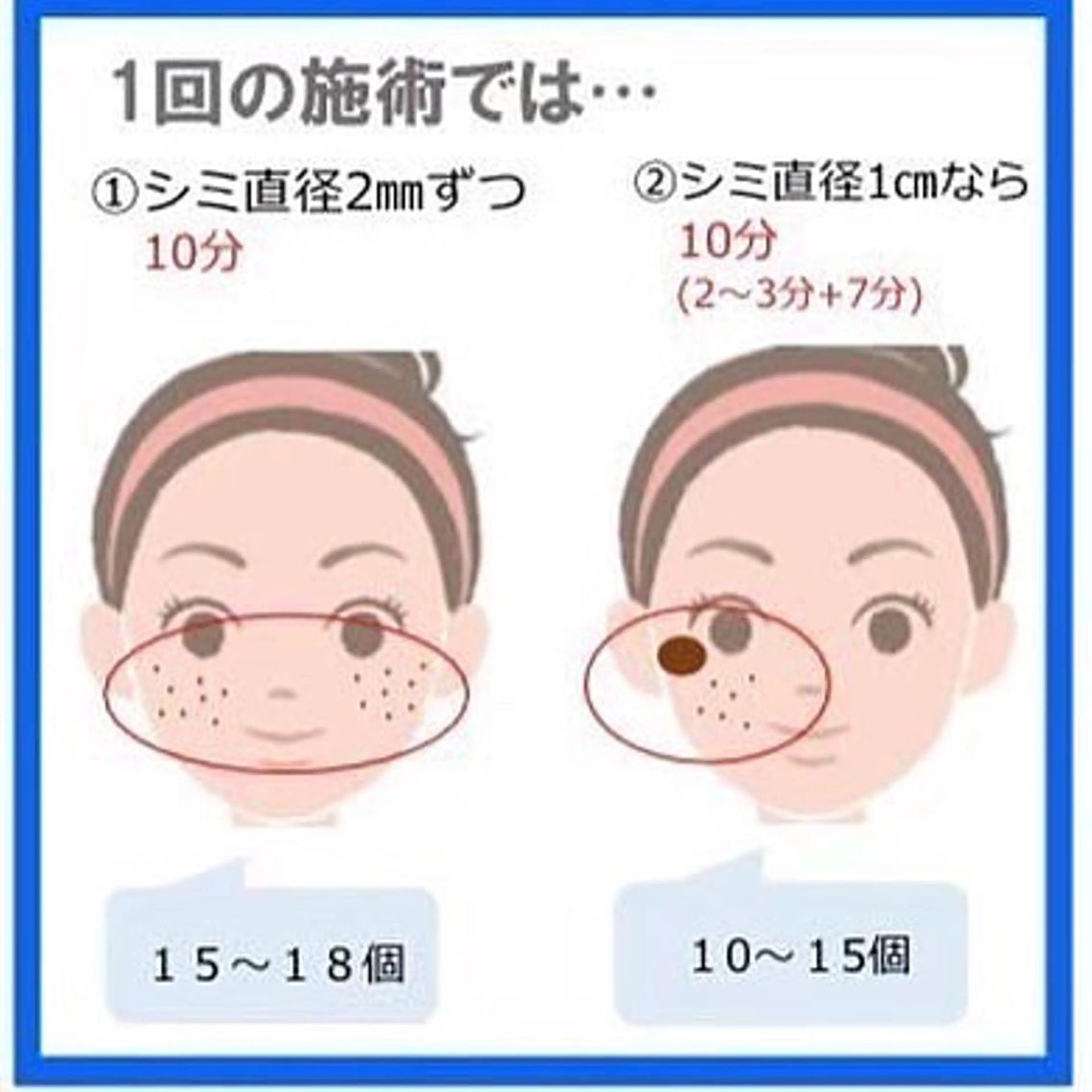 【ニキビ/肌管理】 salon varyのエステ・リラクイメージ