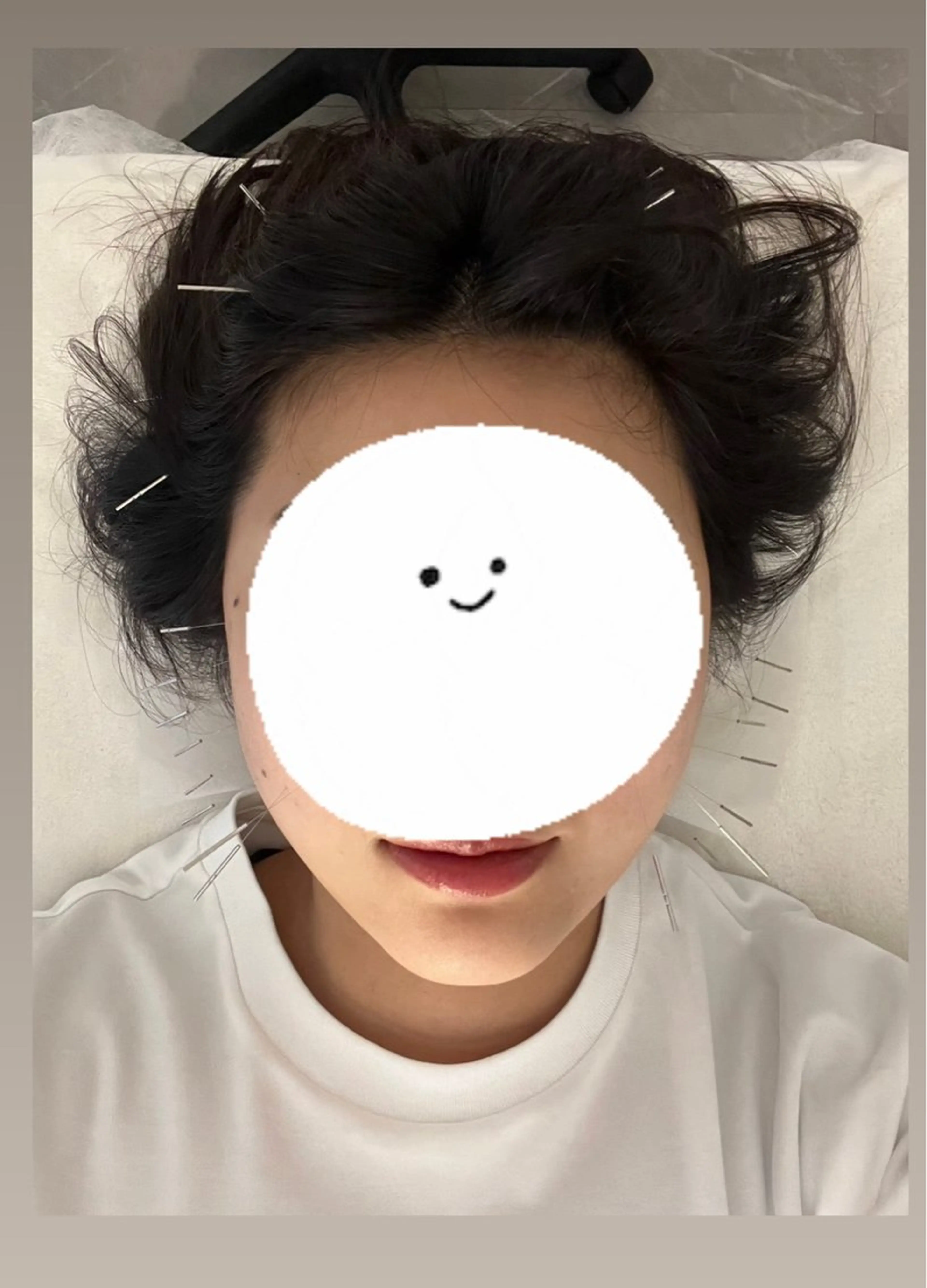 札幌鍼灸FUJIKAWA所属・札幌鍼灸 FUJIKAWAのエステ・リラクイメージ