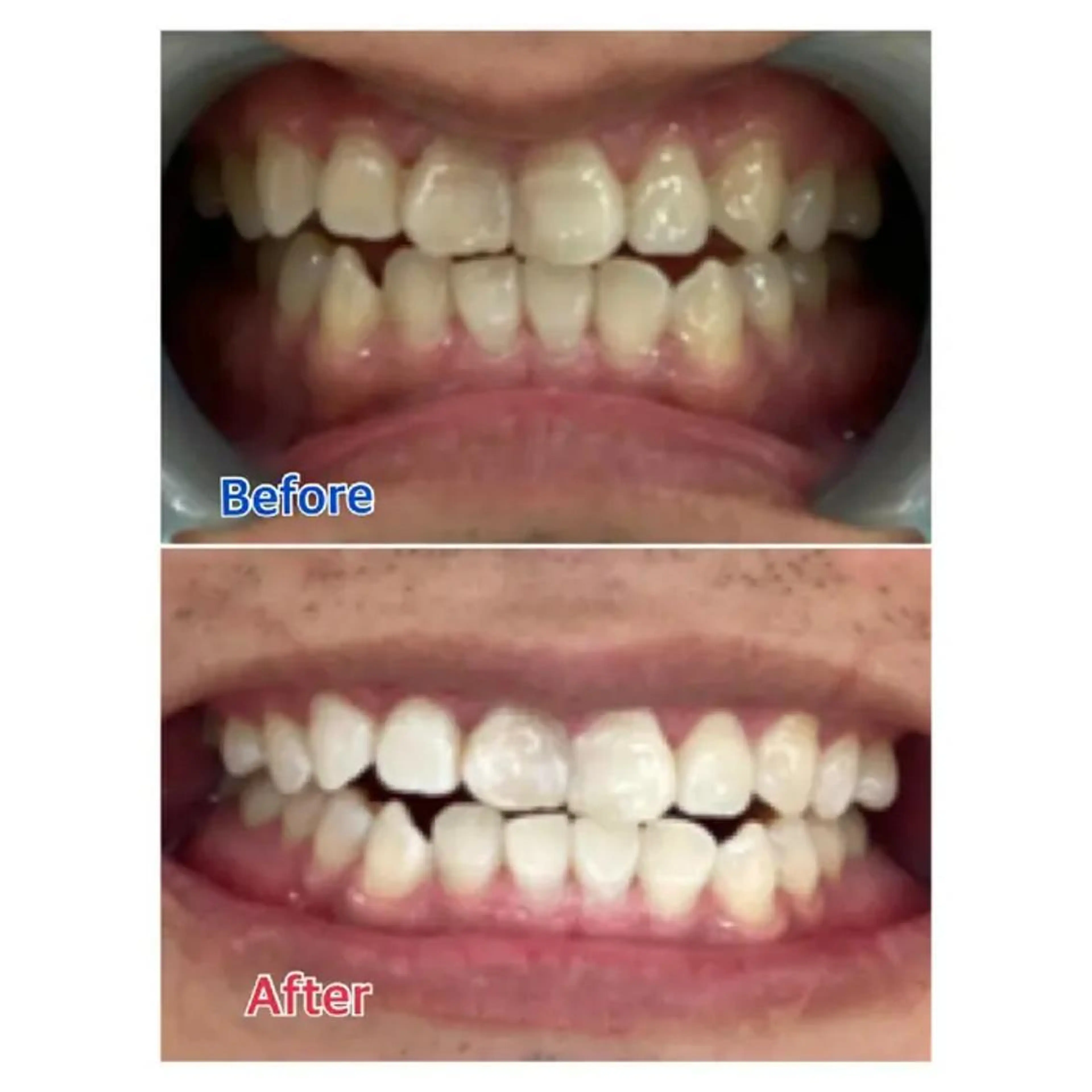 M渋谷店所属・M渋谷 ホワイトニングのエステ・リラクイメージ