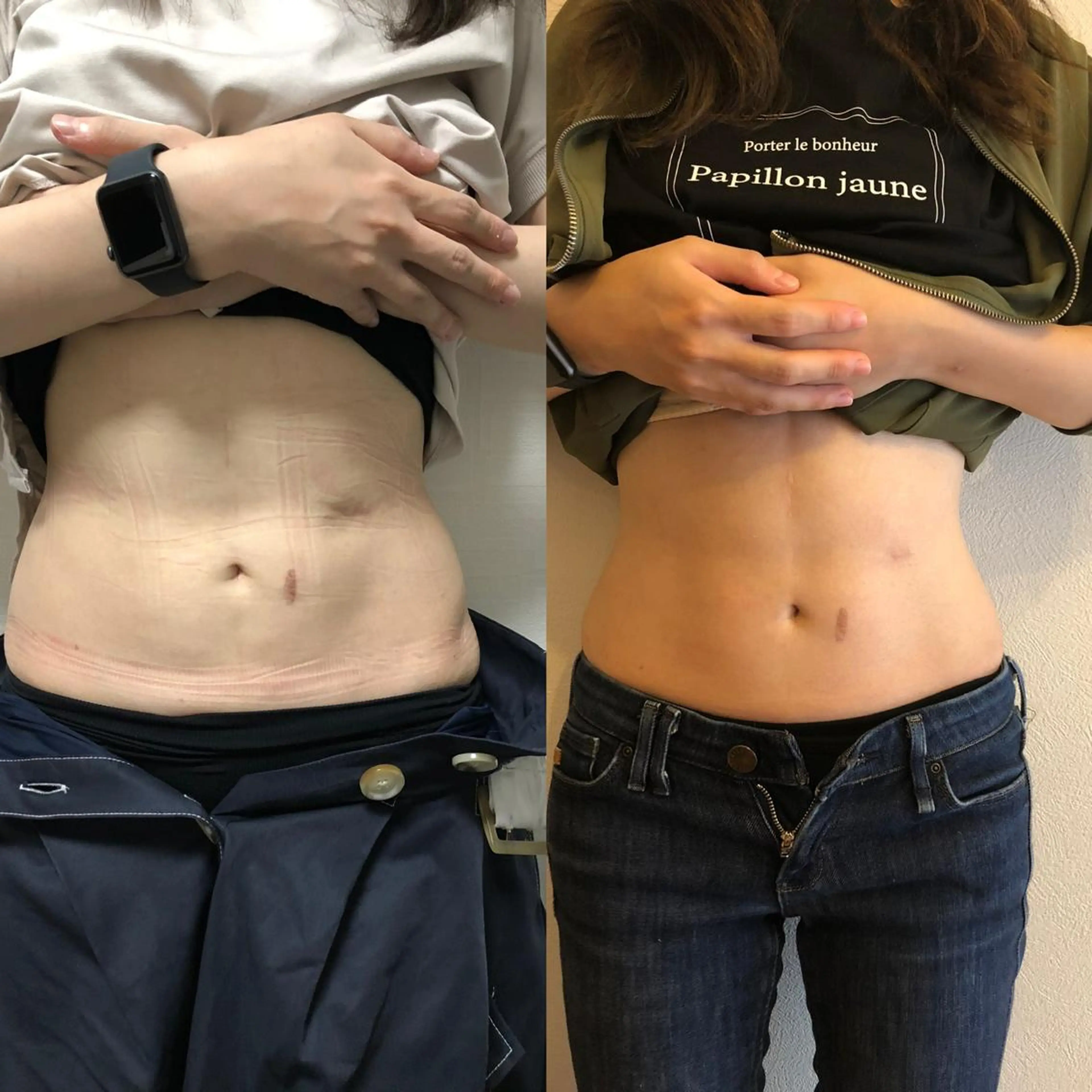 エステ リラク 鹿児島腸もみサロン Deparchoのエステ・リラクイメージ