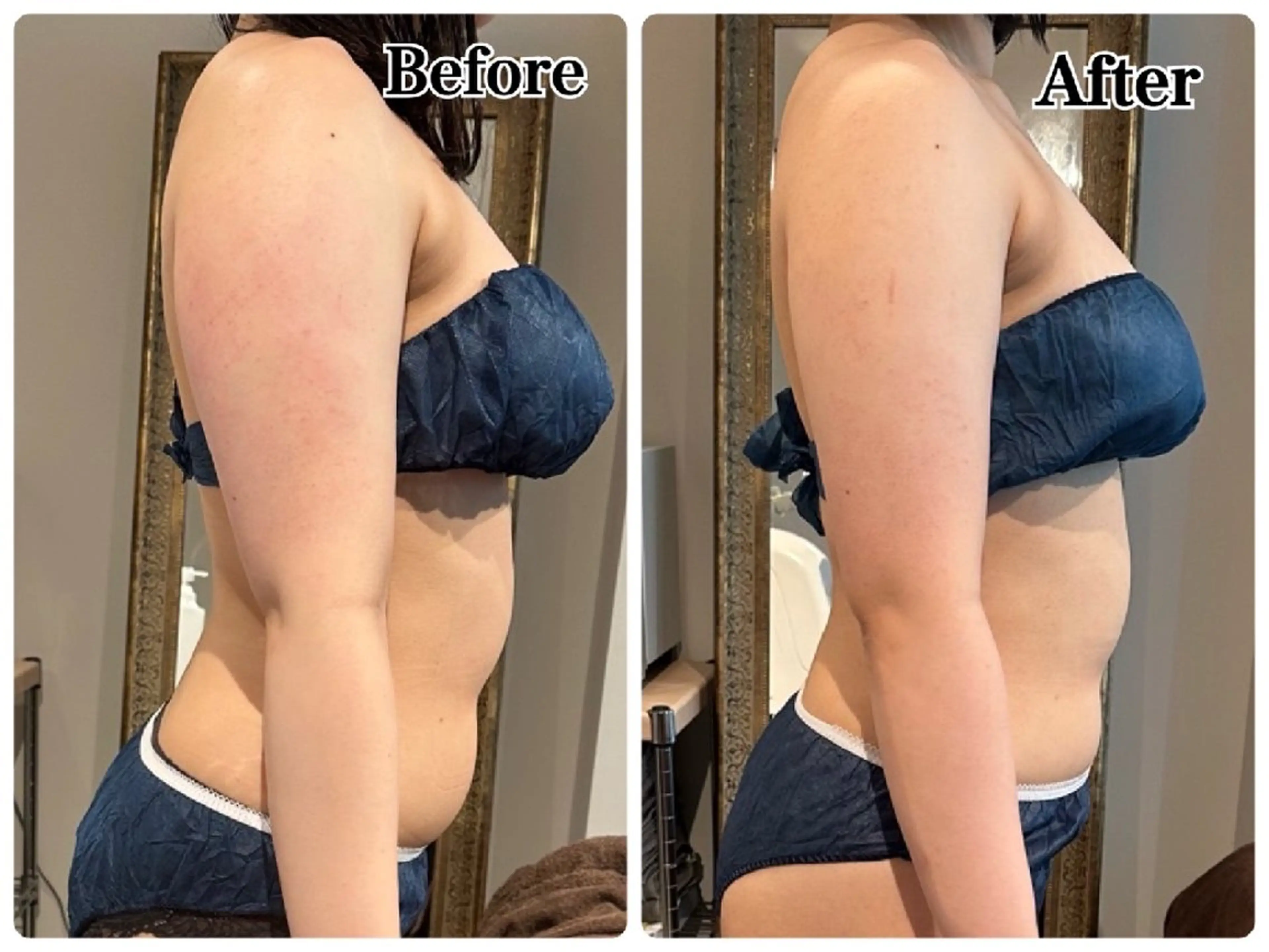 寝てるだけで-〇センチ！？セル脂肪痩身✨体験1回のみの写真