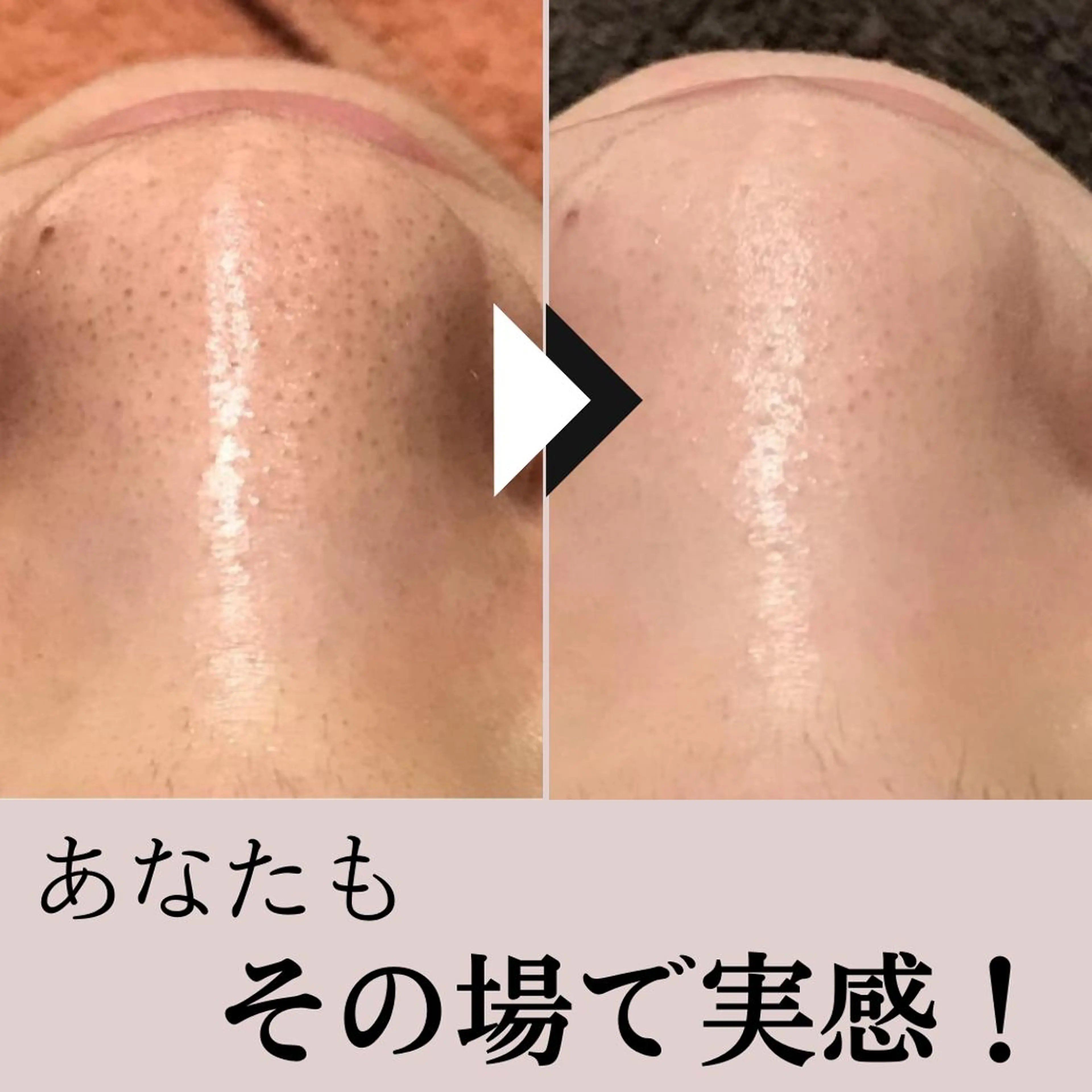 毛穴専門店Bébé 大阪中央店のエステ・リラクイメージ