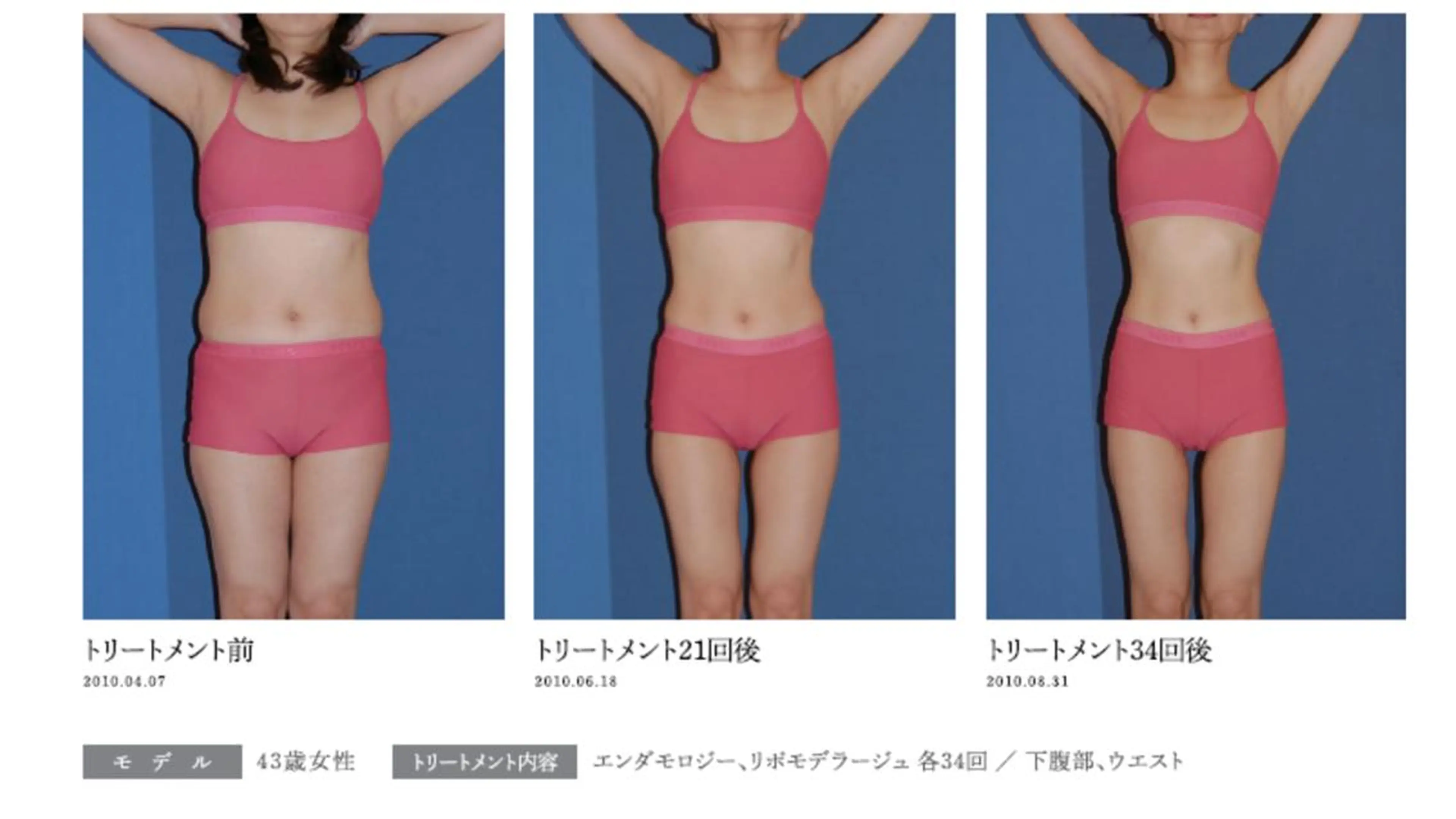 オレンジバナナ 新潟店のエステ・リラクイメージ