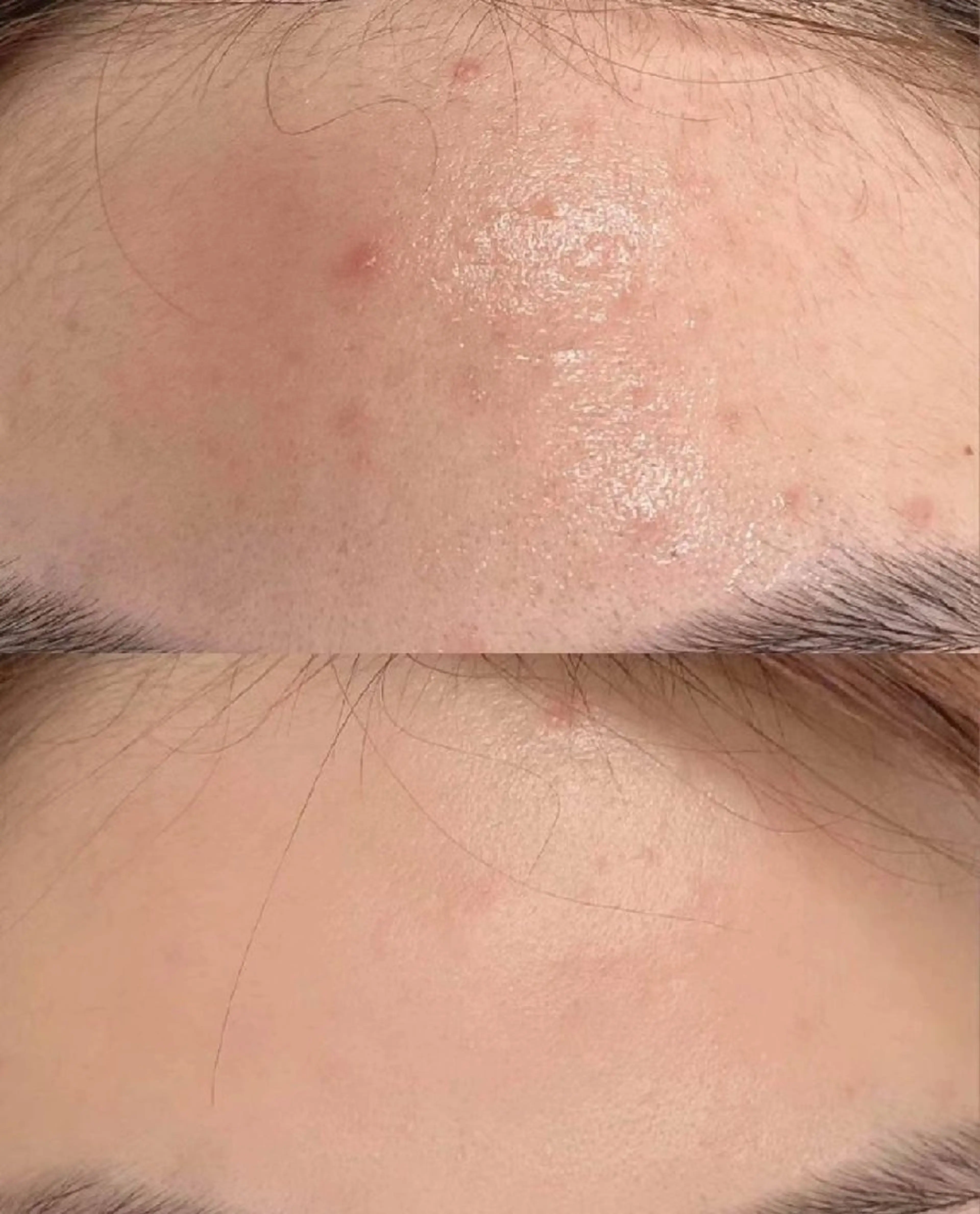 ネイル ブライダルネイル aliaハイフ&水光ジェットサロン所属・aliaハーブ水光店 エステティシャン募集のエステ・リラクイメージ