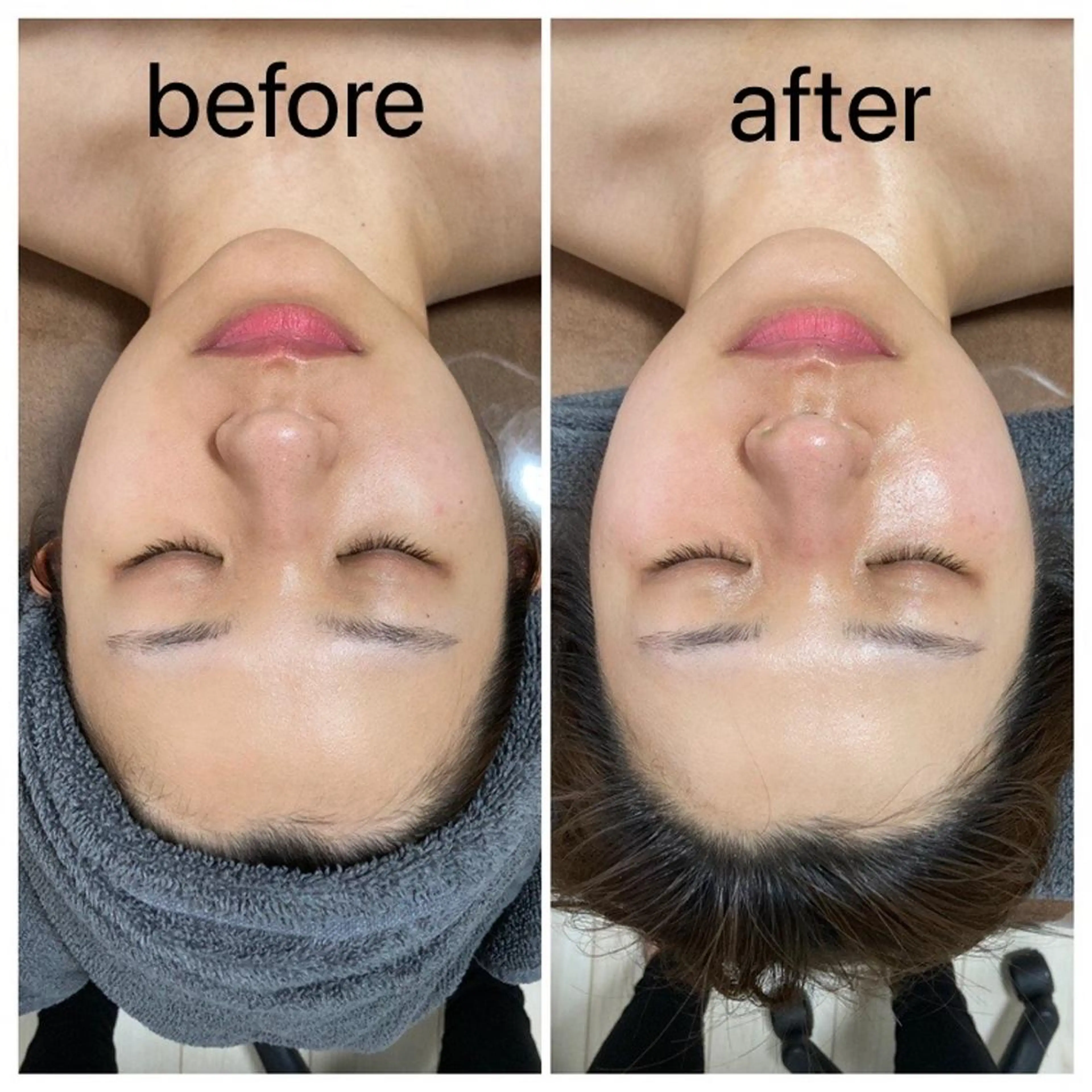 キメ整え・美肌ケアの写真