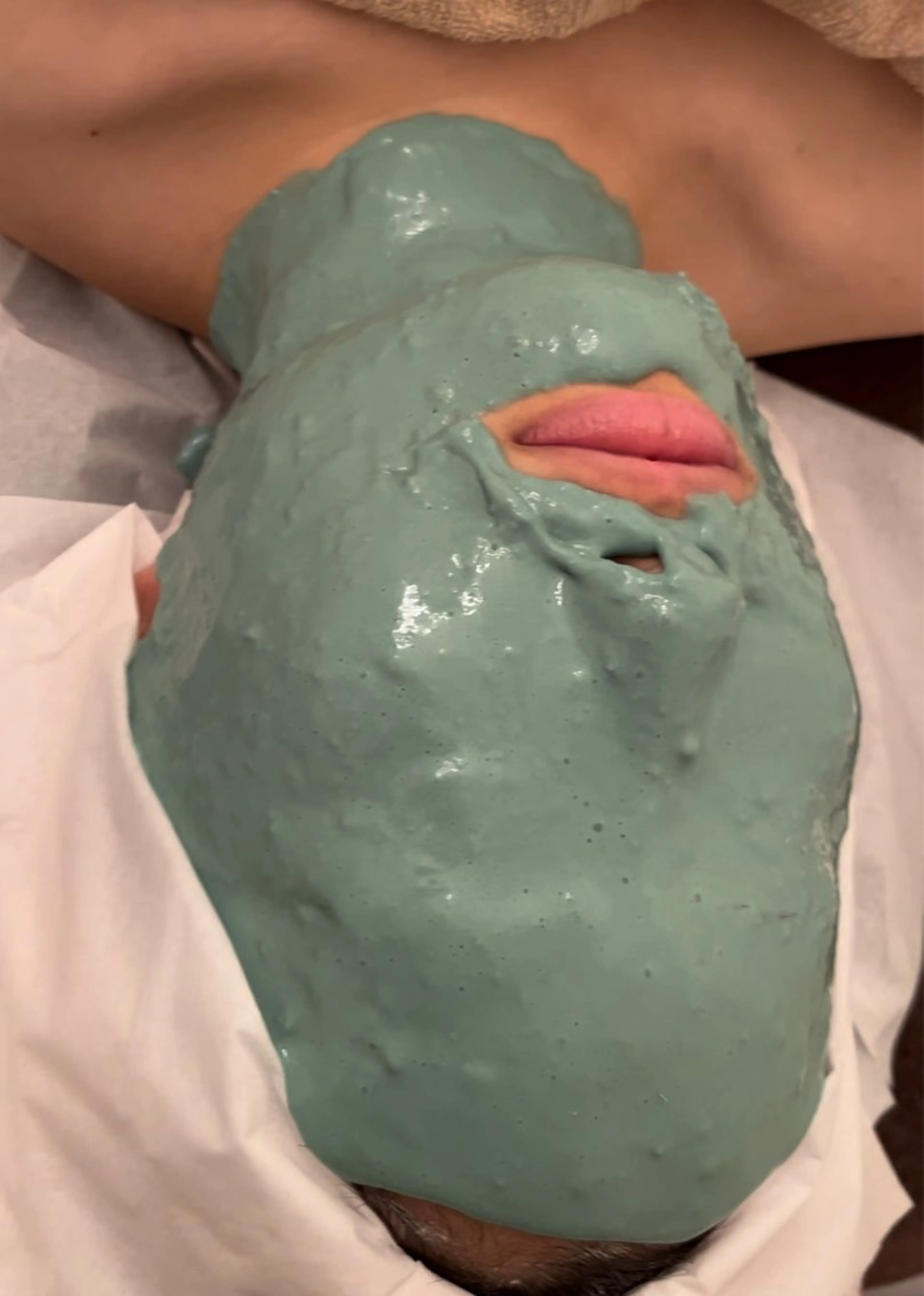 《鼻の毛穴が黒い？》顔脱毛×ハイドラフェイシャル/毛穴引き締め効果◎透明感UP！の写真