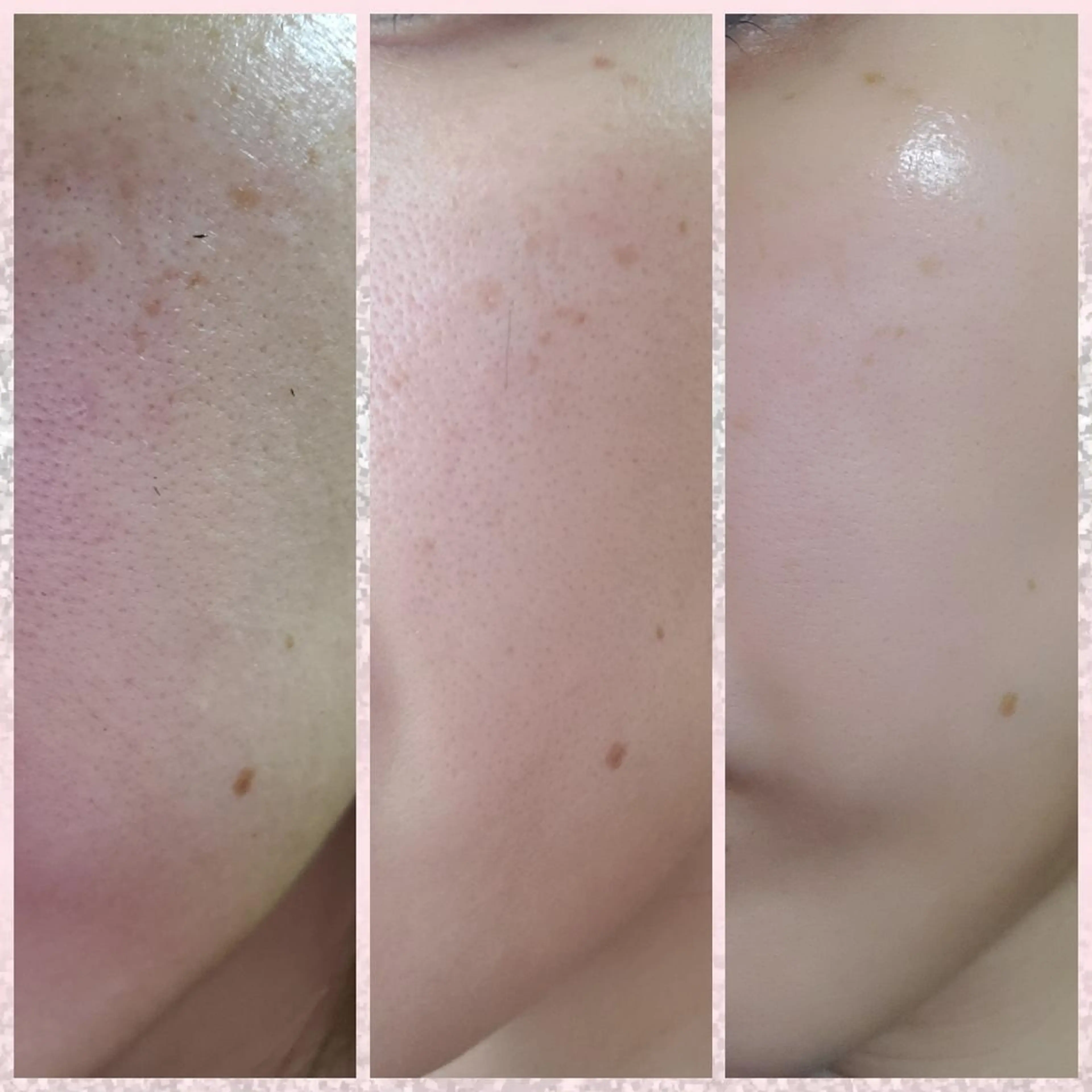 エステ beauty SalonRcoinのマツエク・マツパデザイン