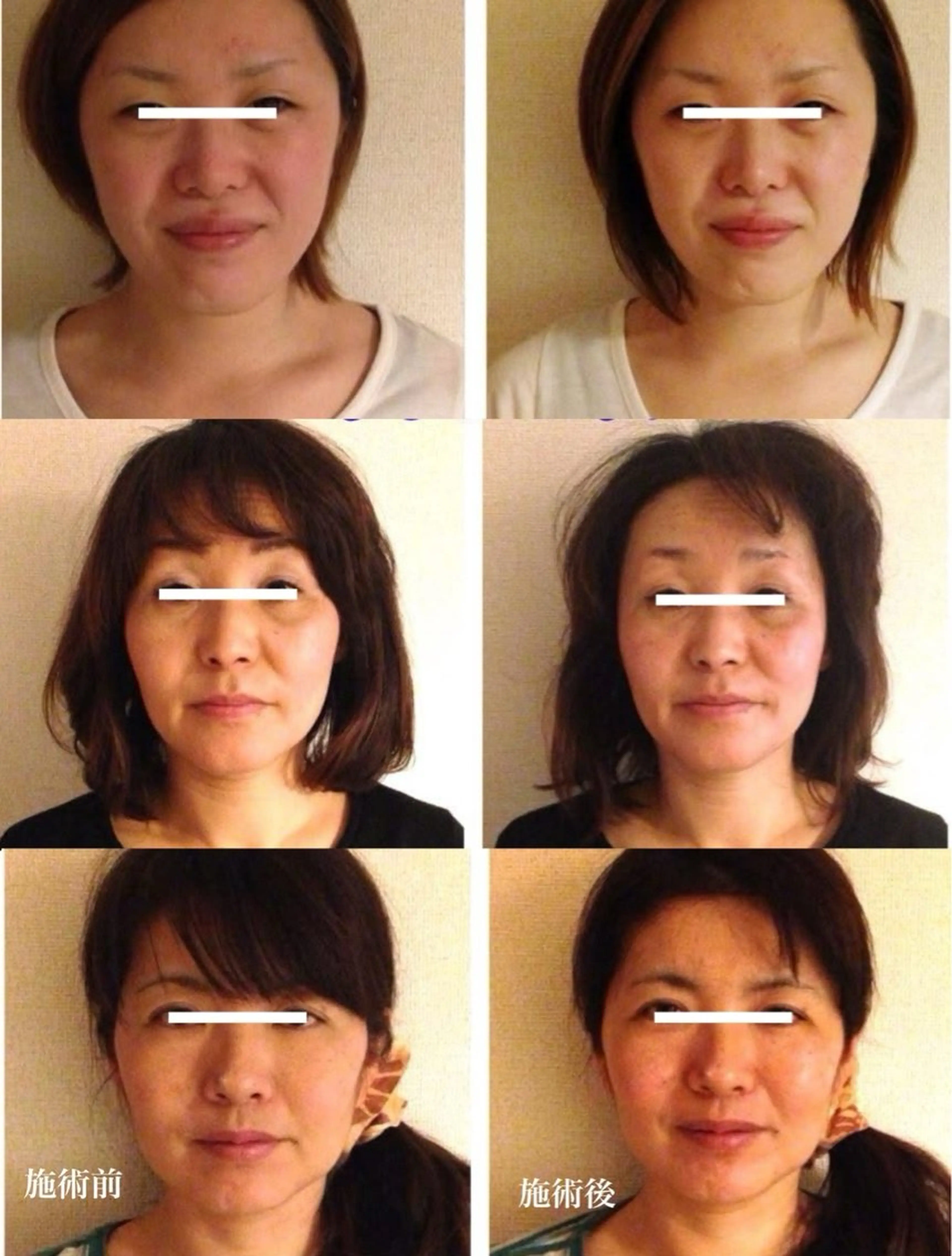 痩身・小顔・骨盤矯正×ヒップアップ専門エステ Peach所属・桃尻つかさ🍑小顔× ノーファンデ肌作りのエステ・リラクイメージ