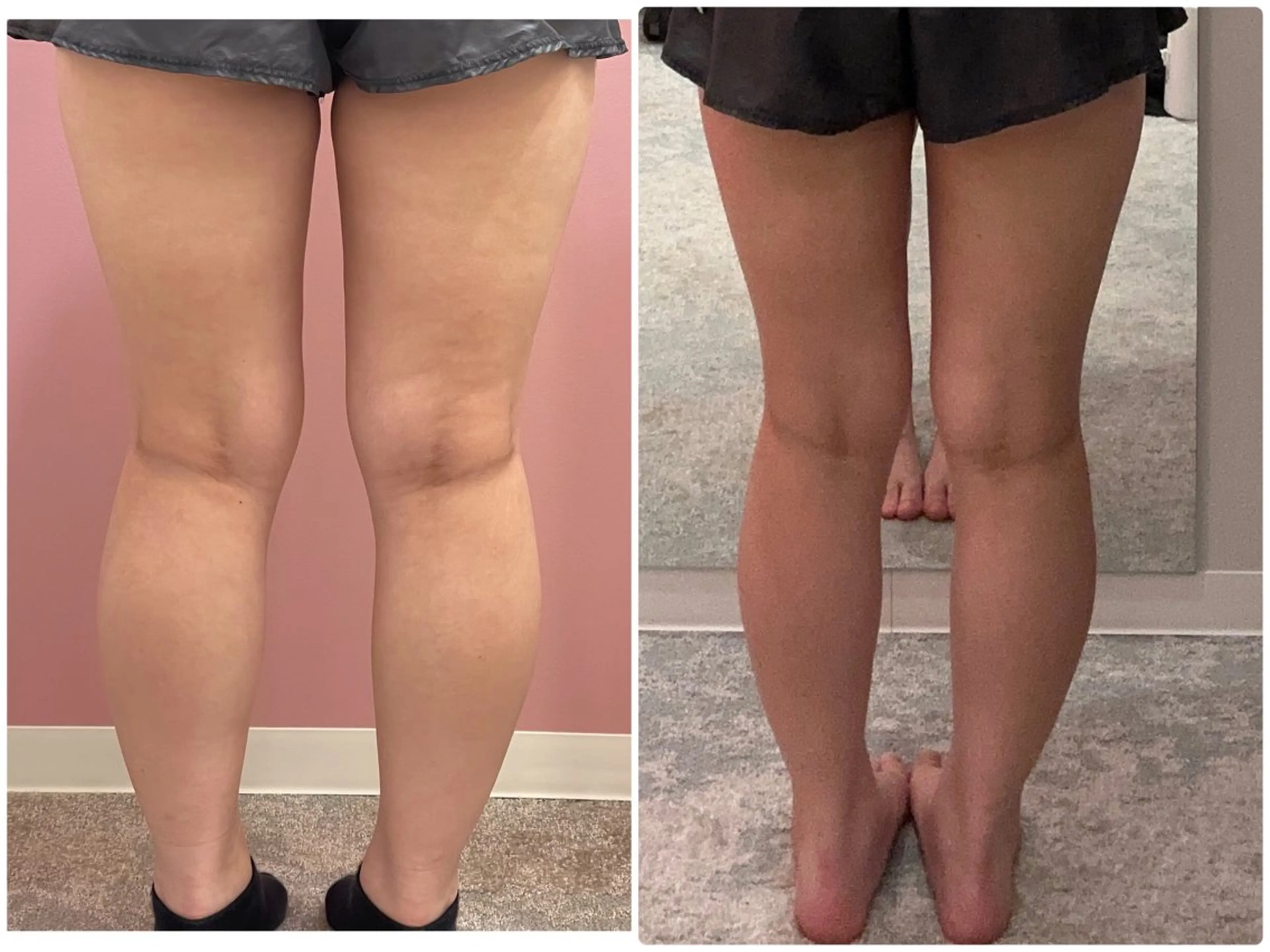 エステ初回体験（身体）の写真