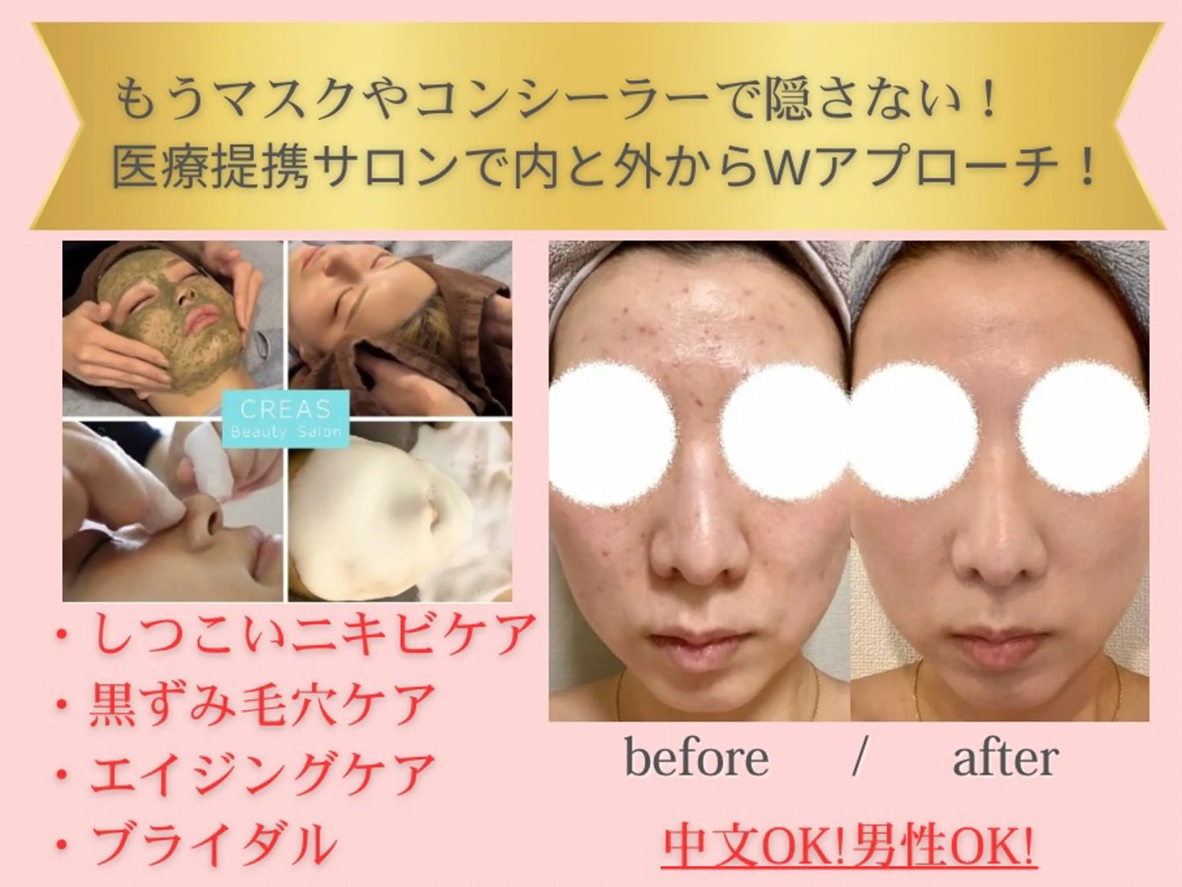 エステ クレアス勝どき・肌質改善専門店【CREAS Beauty Salon】所属・クレアス勝どき【毛穴 ハーブピーリング専門のエステ・リラクイメージ