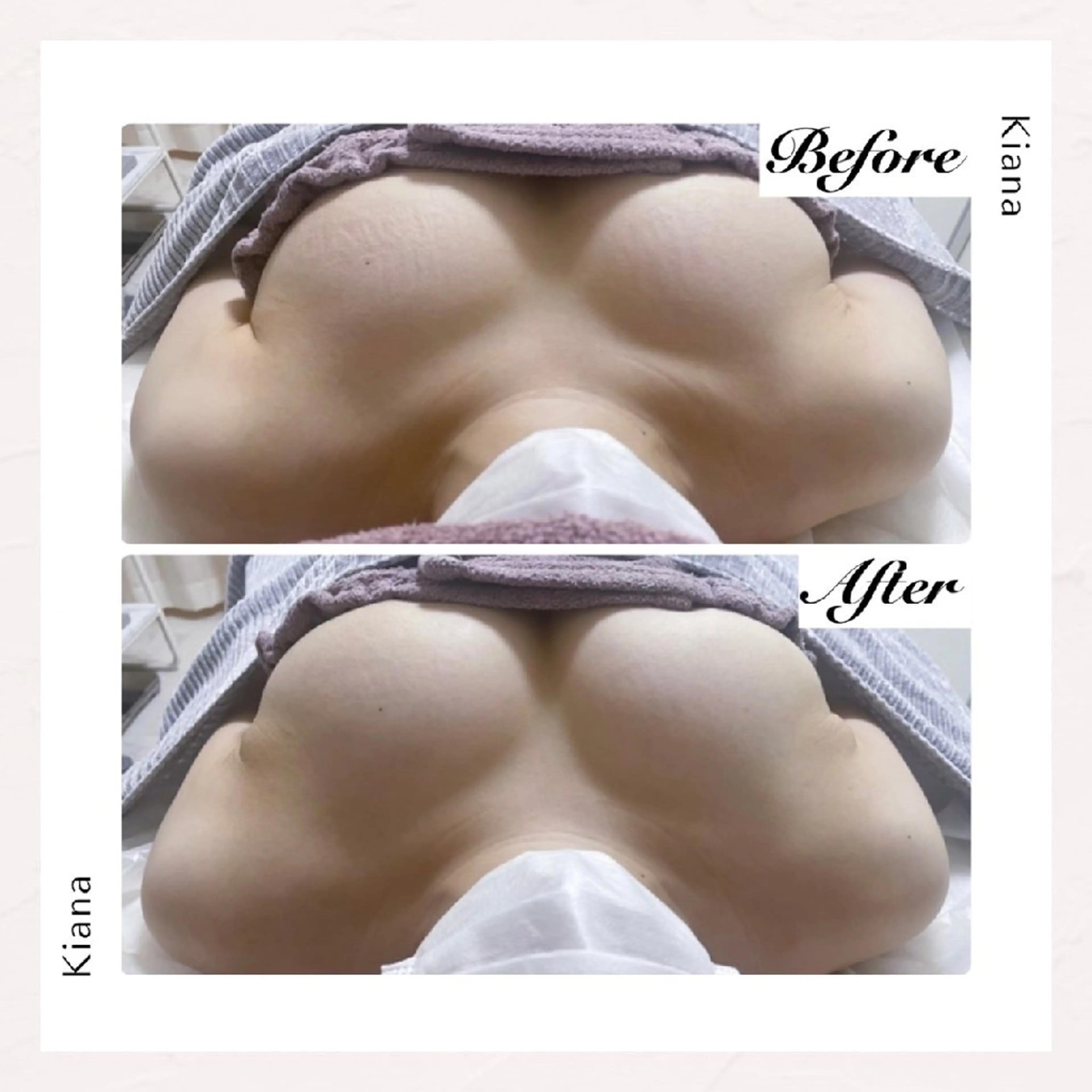 【バスト専門店 】 Kiana のエステ・リラクイメージ