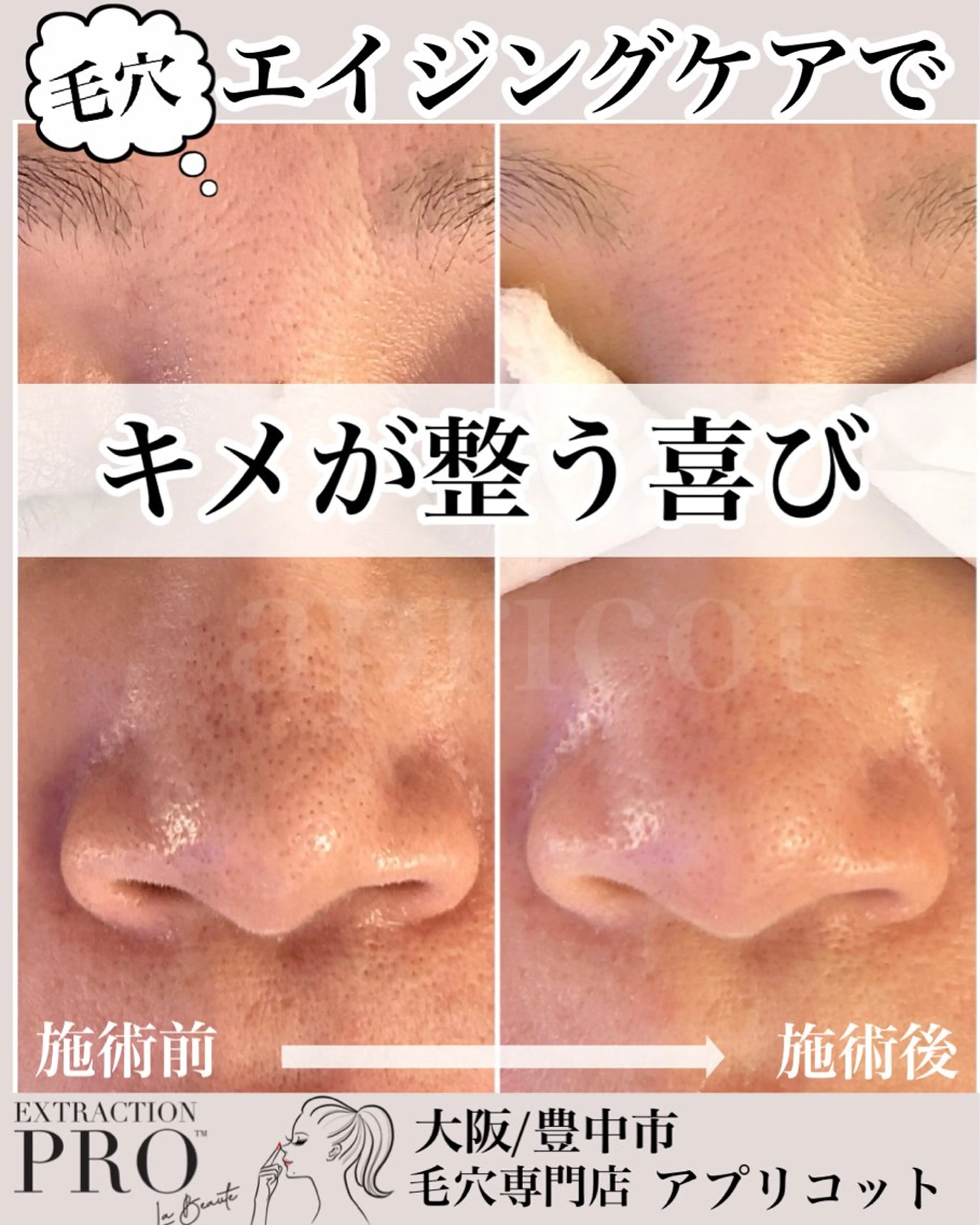 ヘッドスパ専門/豊中 apricotのエステ・リラクイメージ