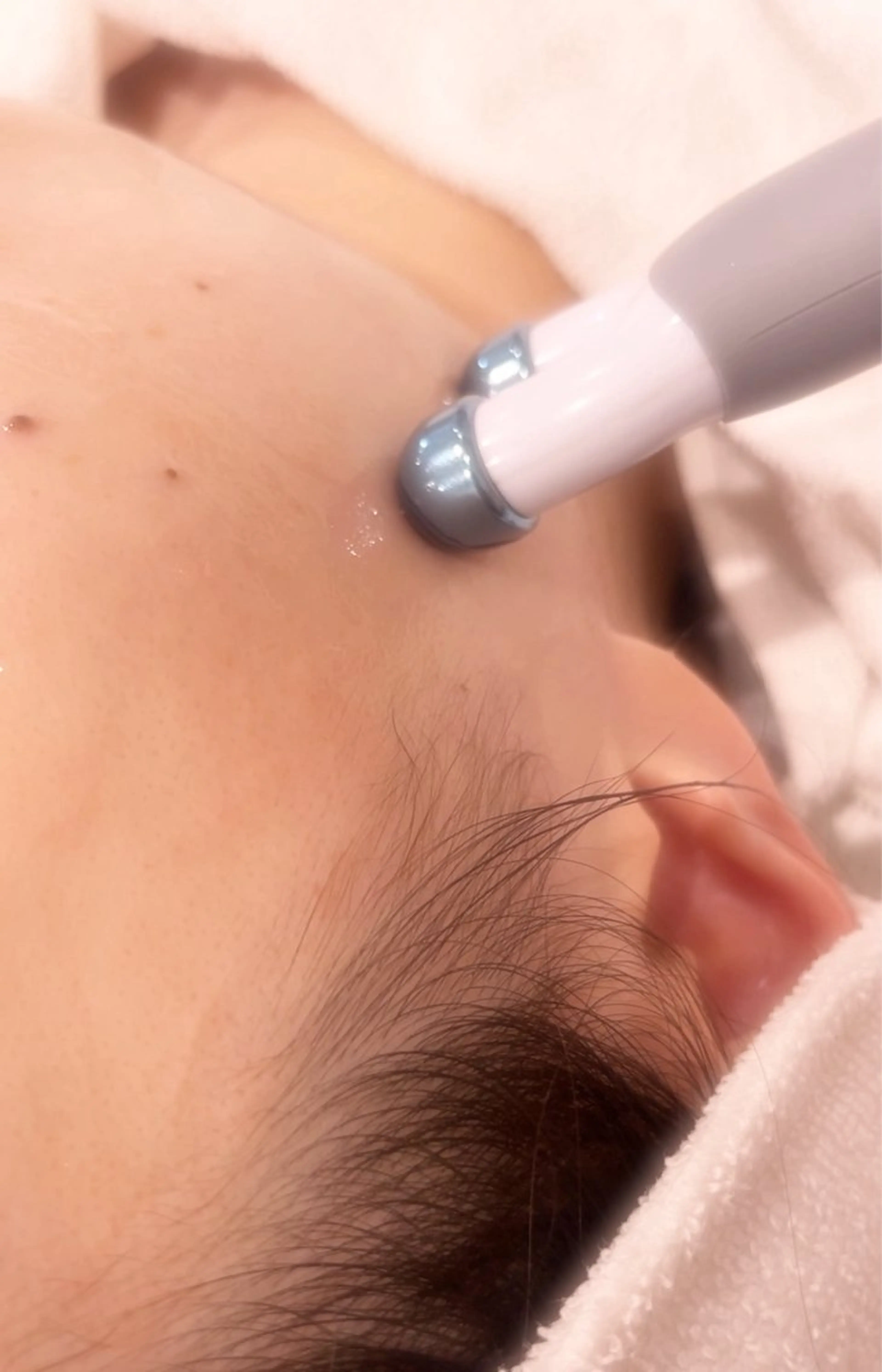 電気の力で効果実感、ポレーションエステの写真