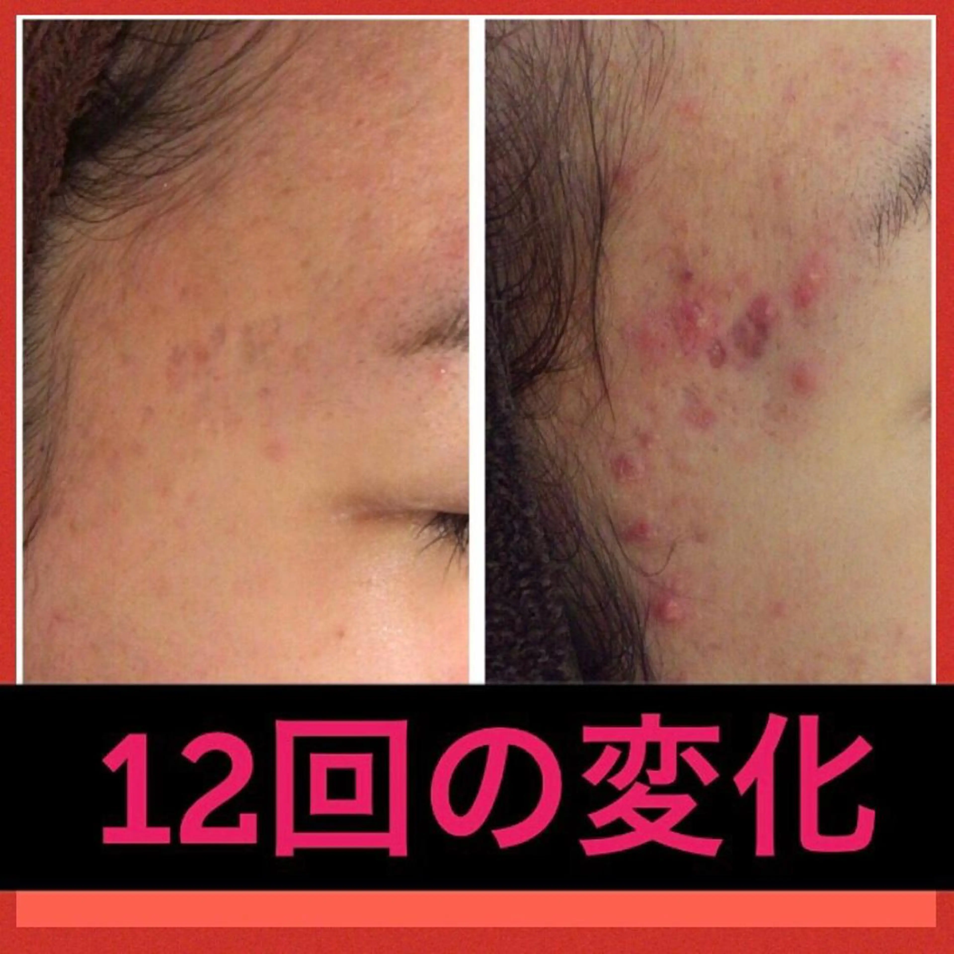 ミディアム カラー パーマ ヘアアレンジ メンズ ネイル マツエク・マツパ エステ リラク ニキビ・肌質改善専門 ♡人生が変わるサロンのエステ・リラクイメージ