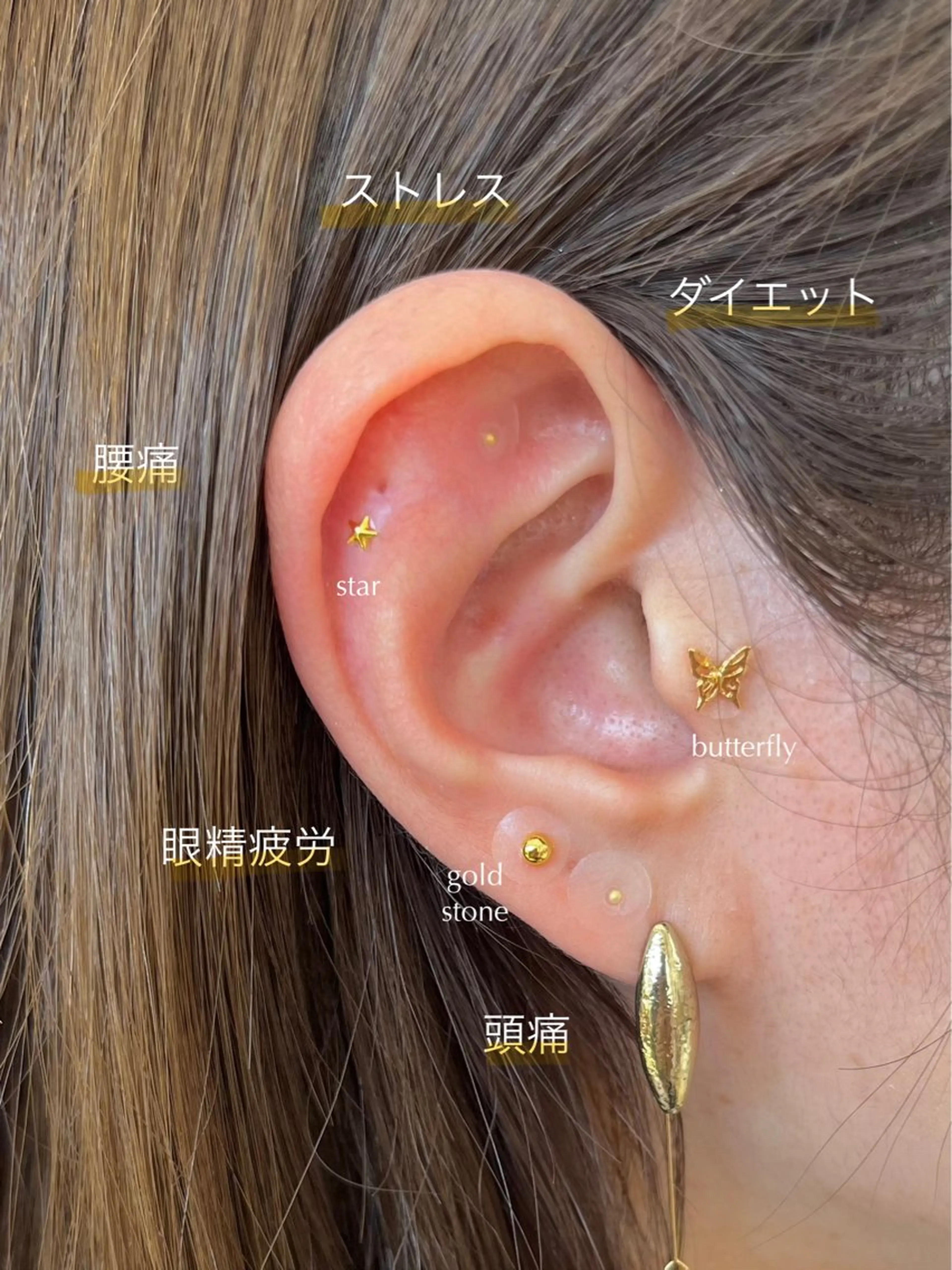 耳つぼジュエリー【両耳10粒】の写真