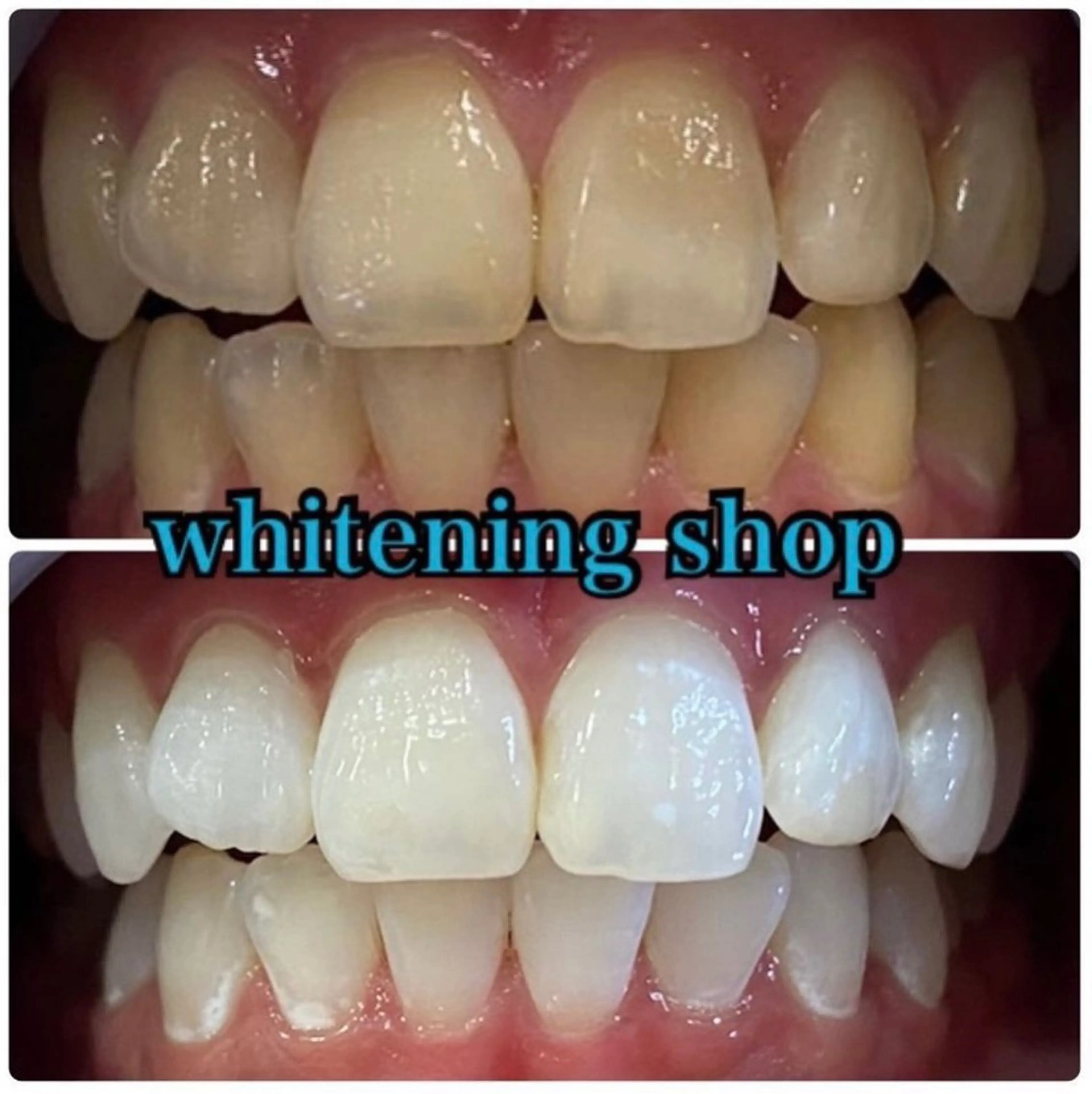 エステ リラク ホワイトニング ショップ吉祥寺店のエステ・リラクイメージ