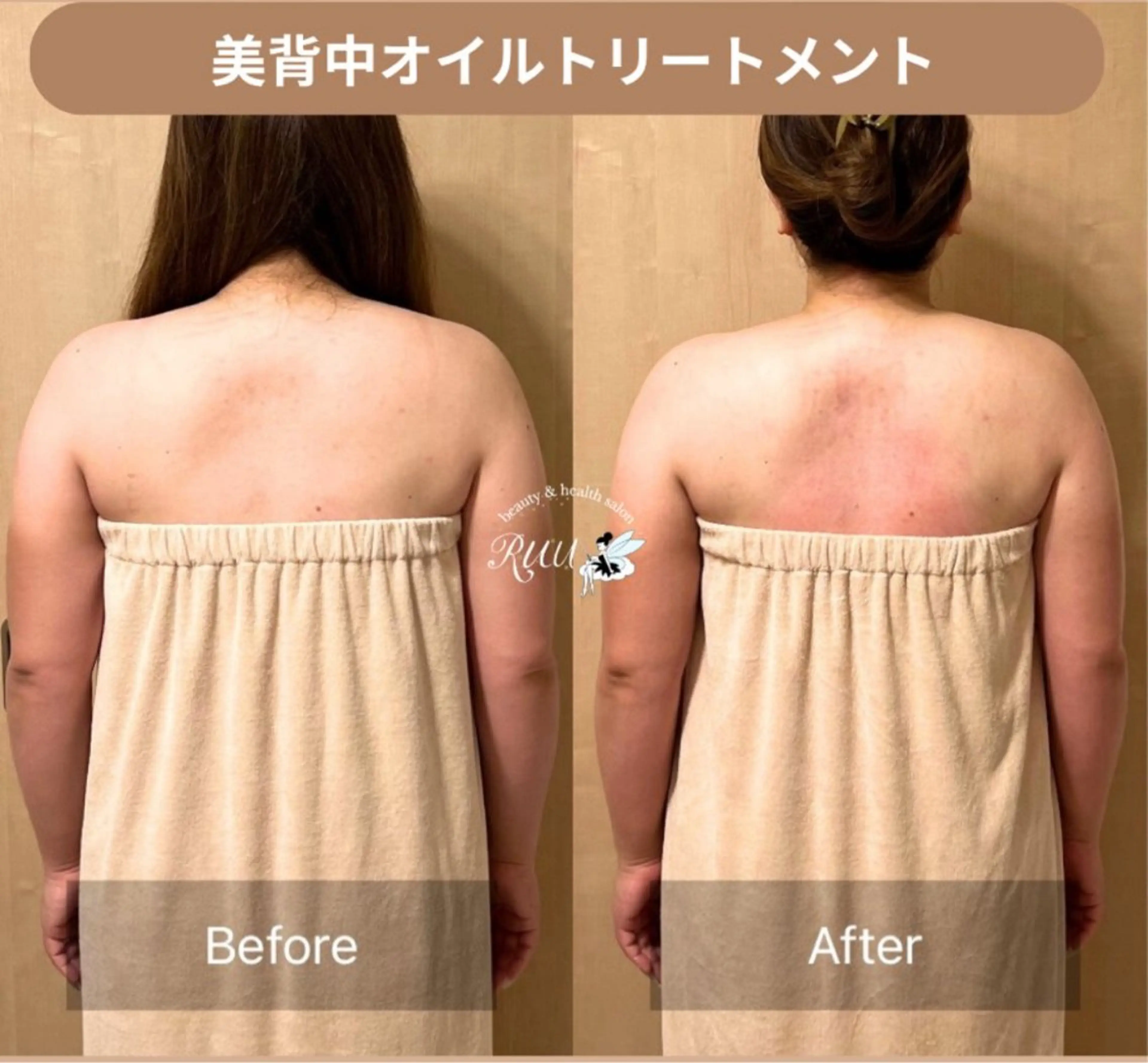 【頭痛、睡眠改善】 salon RUUのエステ・リラクイメージ