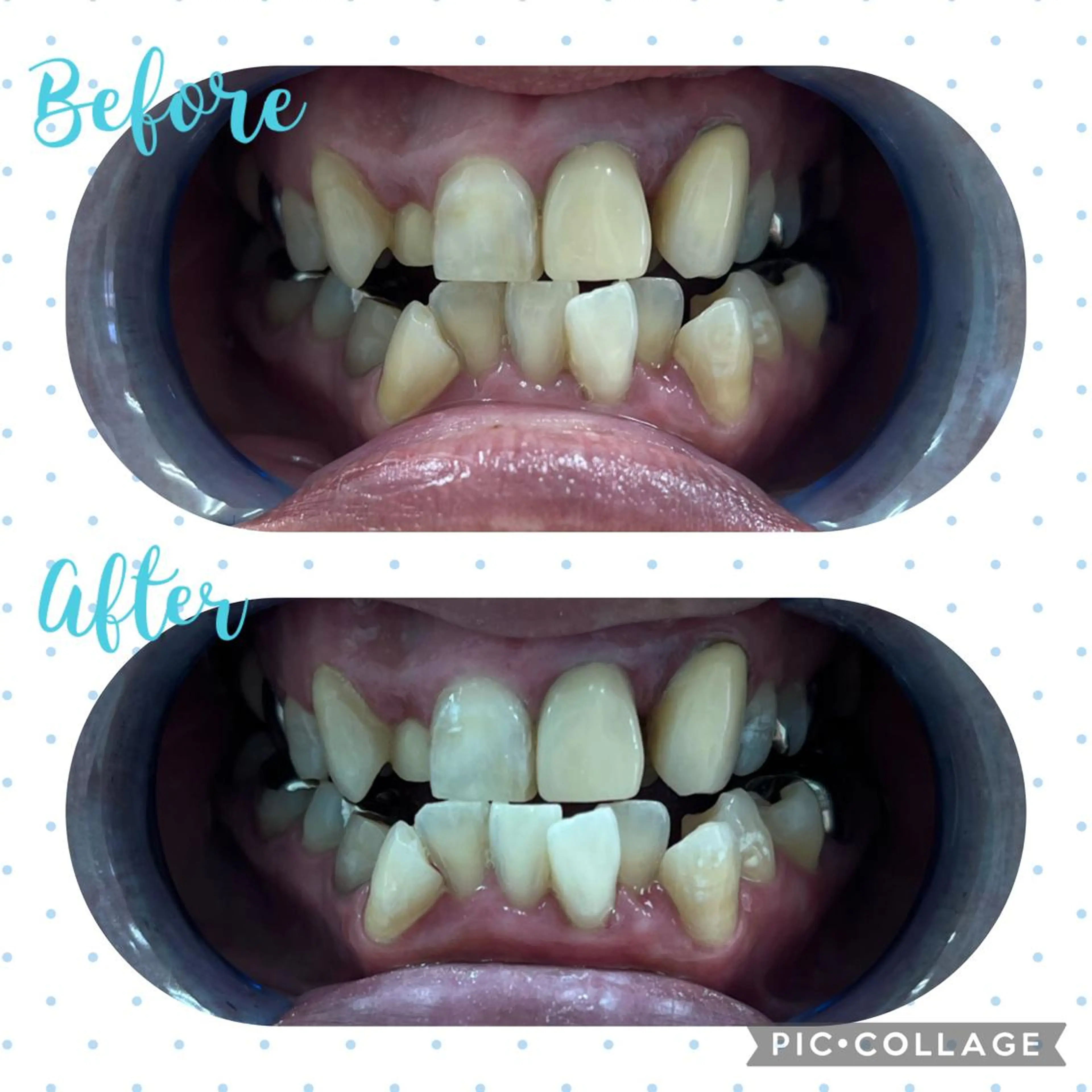 その他 セルフホワイトニングCOCOSHIRO所属・セルフホワイトニング COCOSHIROのエステ・リラクイメージ