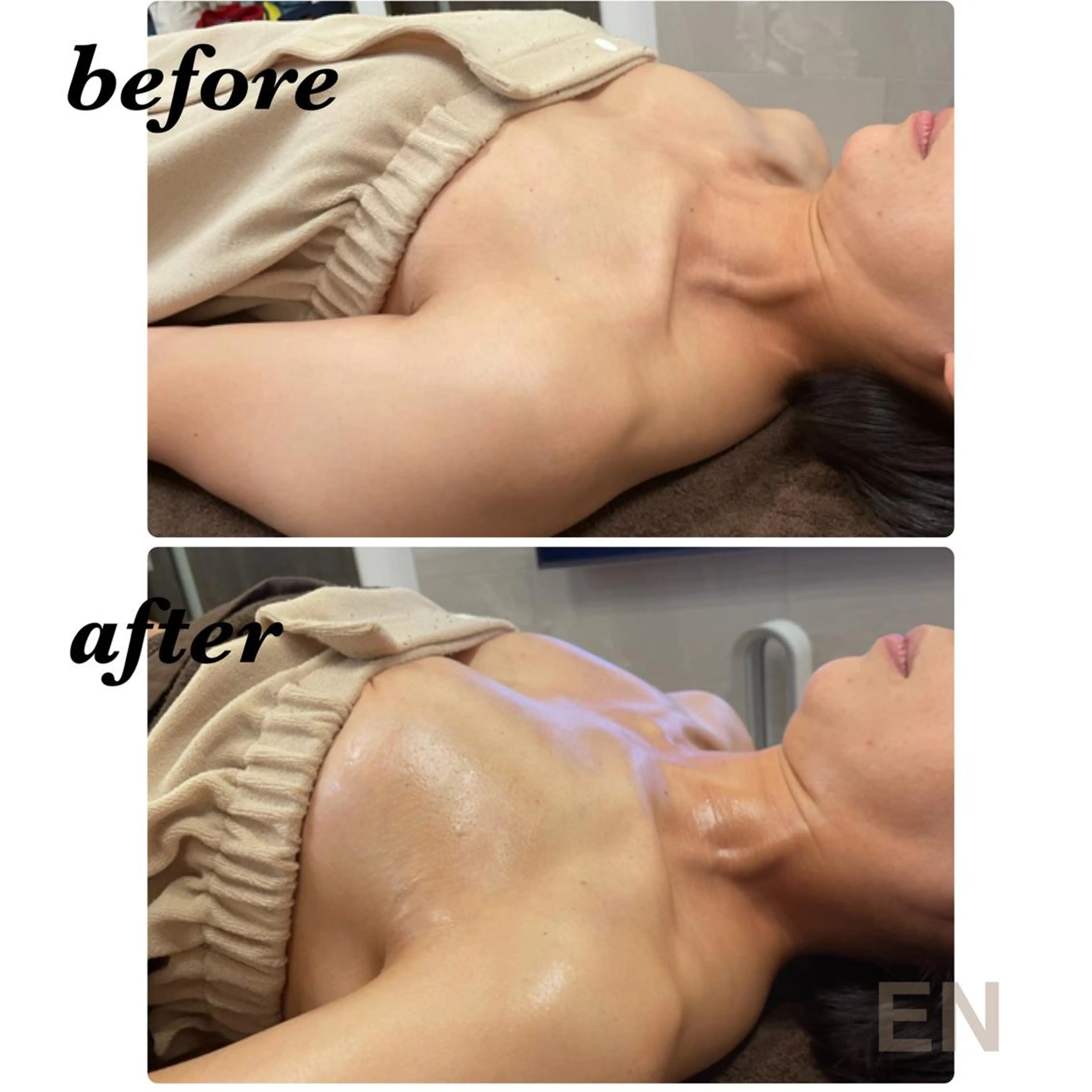 Monreve所属・美人スイッチdiet スーパージェクションのその他イメージ