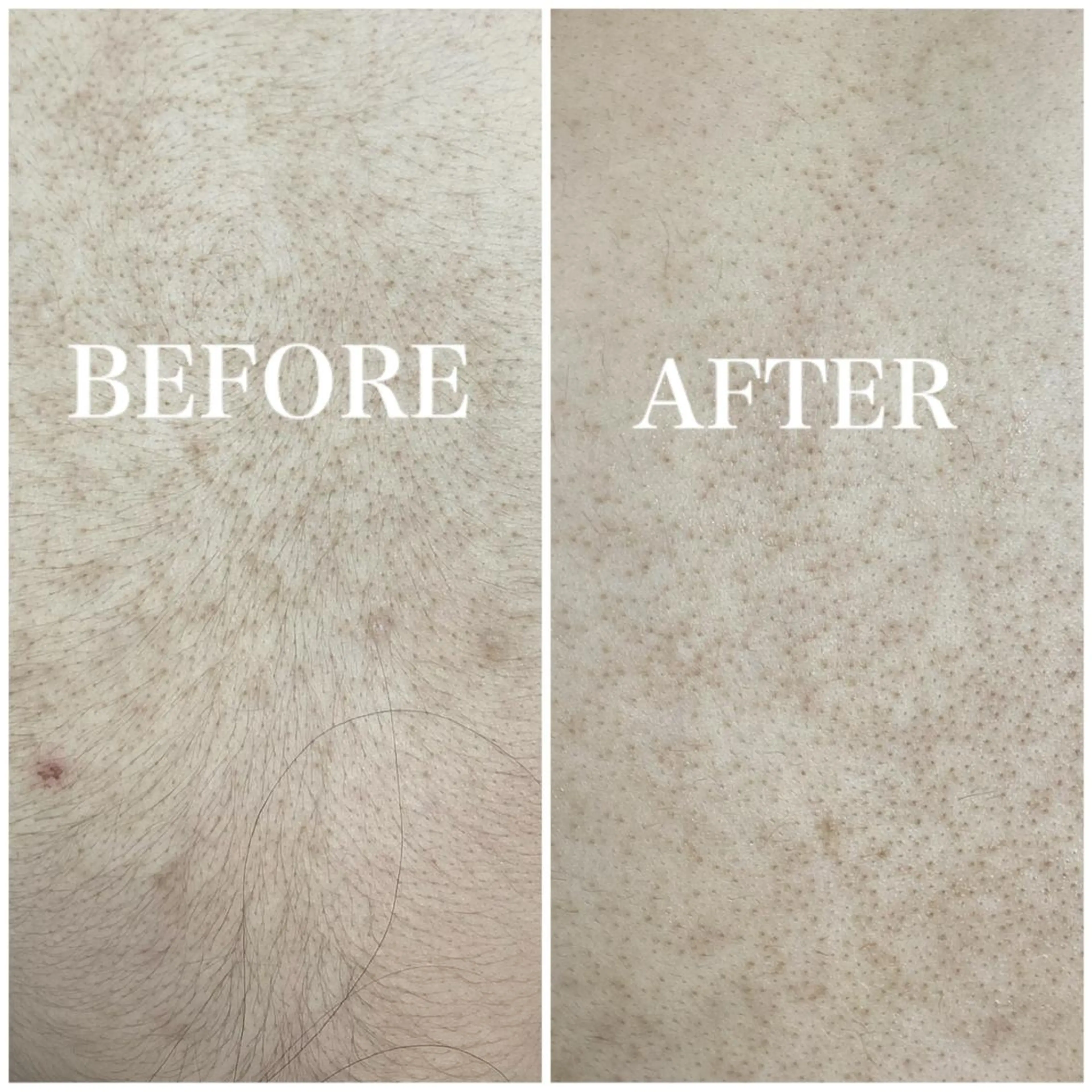 脱毛まつげサロン JESSICA荻窪店の眉毛・アイブロウイメージ