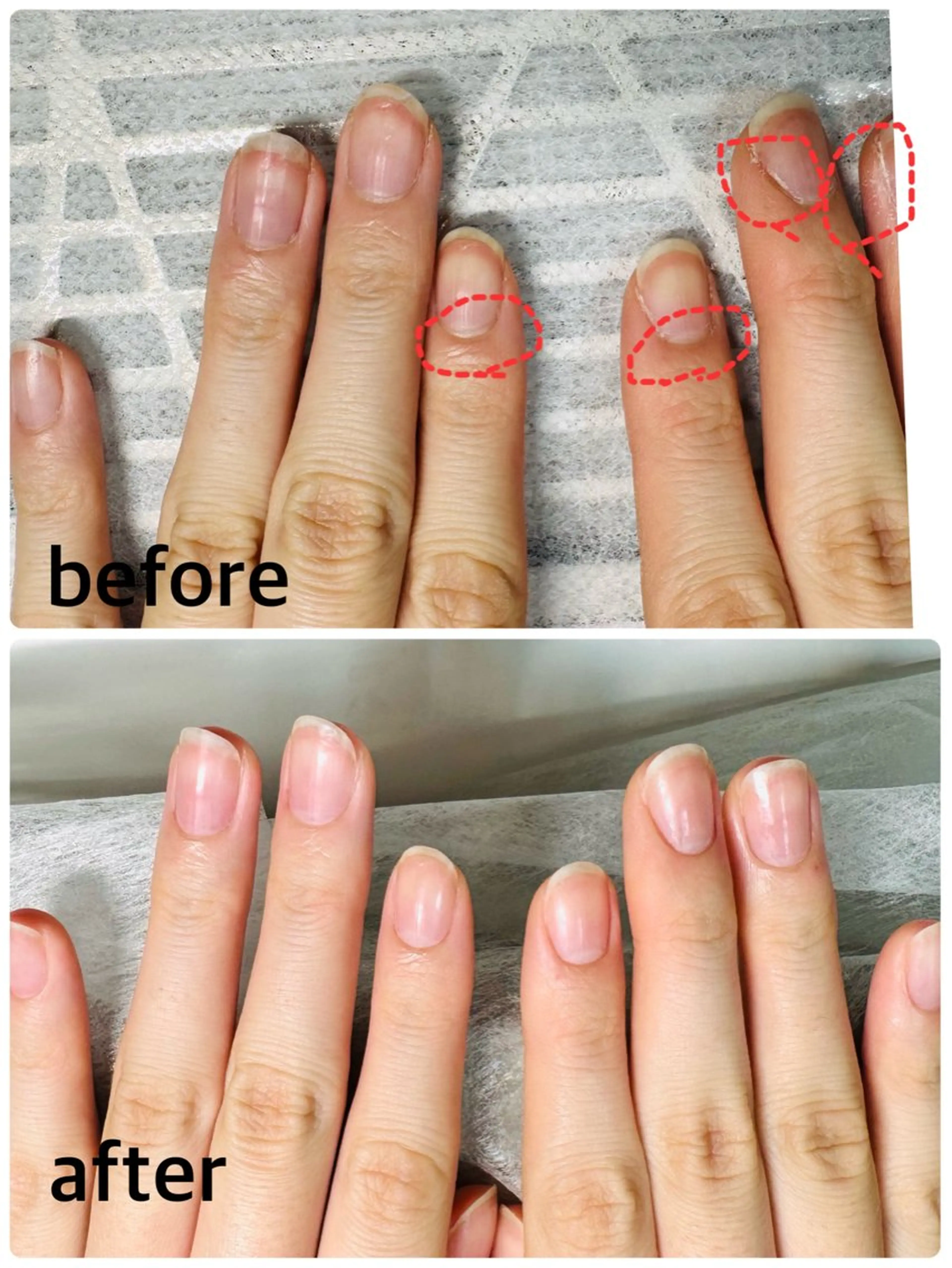 ハンドケアの写真