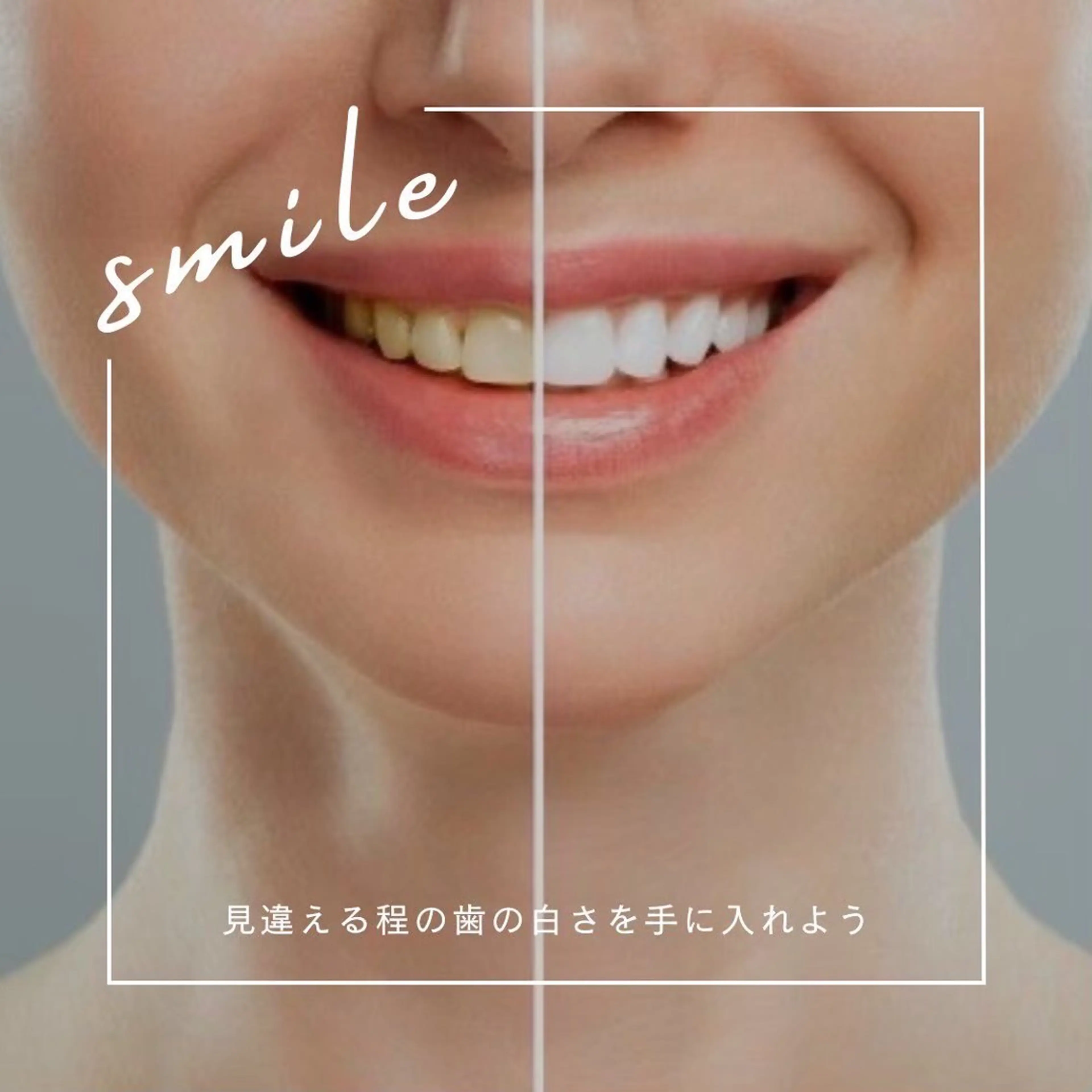 ✨自分磨き納め✨残り5名限定⛄️エリア最長45分美白照射【¥6,980→¥2,000】クチコミ必須✨の写真