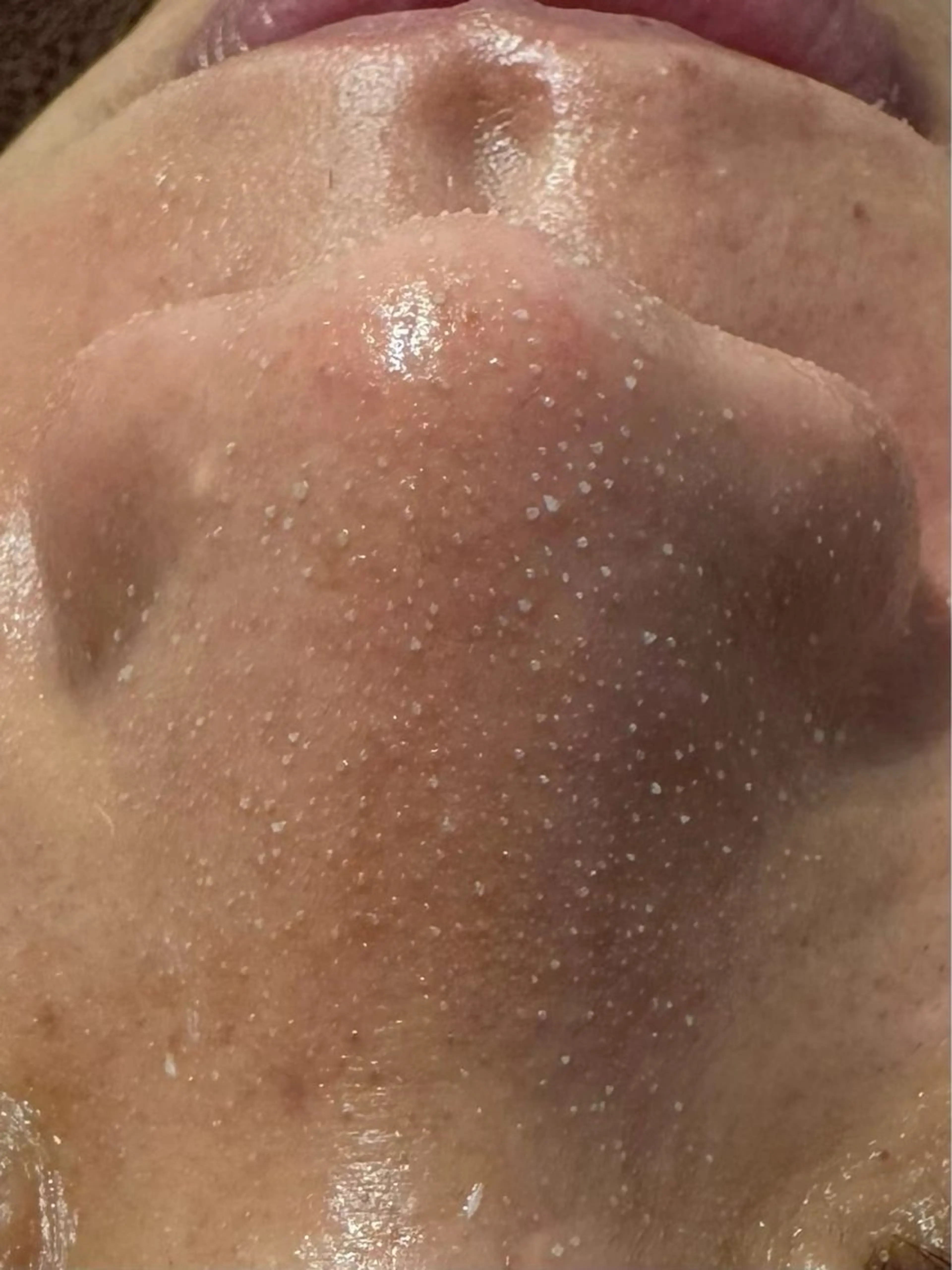 エステ 毛穴洗浄 ワックス脱毛のエステ・リラクイメージ