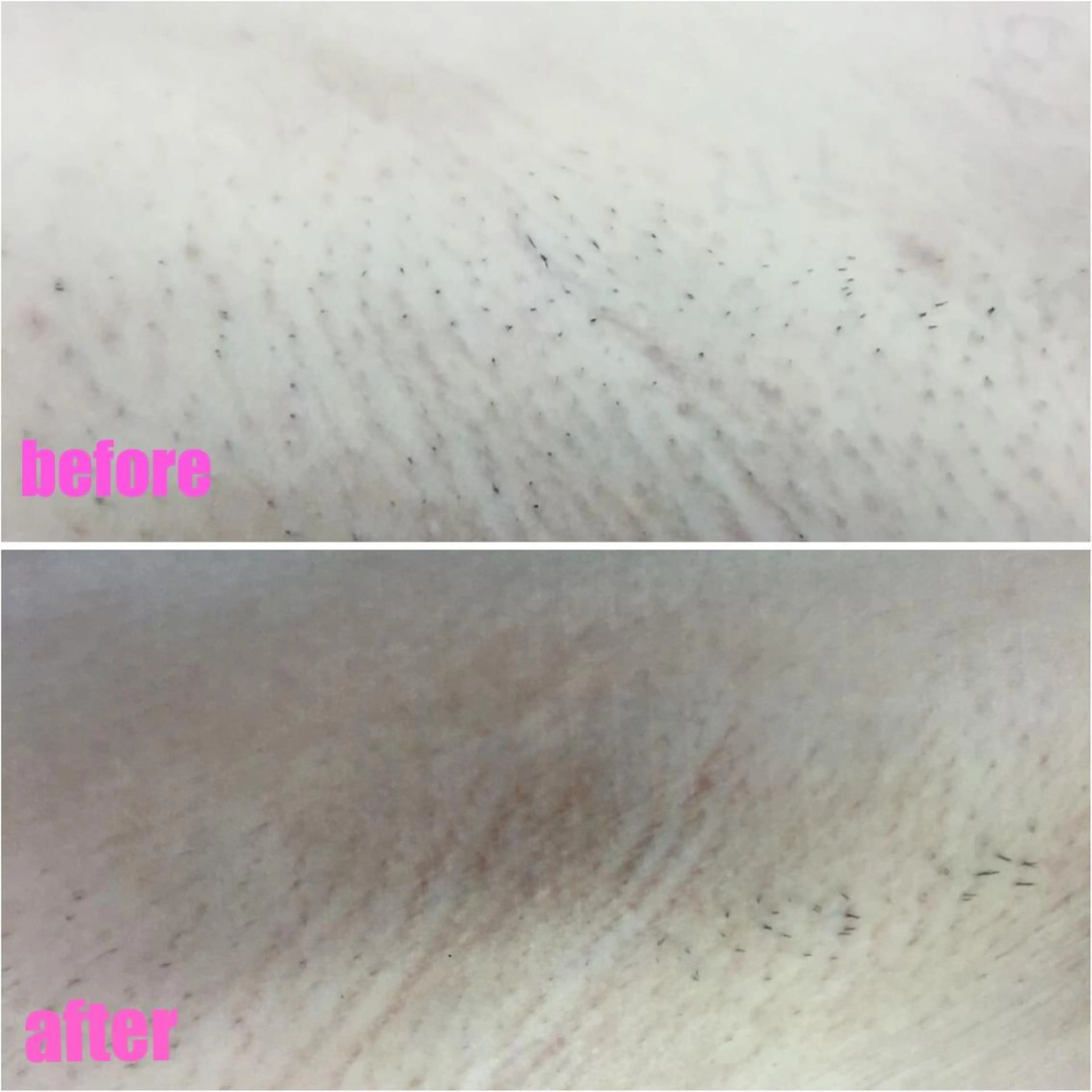 肌ケア＆毛穴洗浄 Cheriのエステ・リラクイメージ