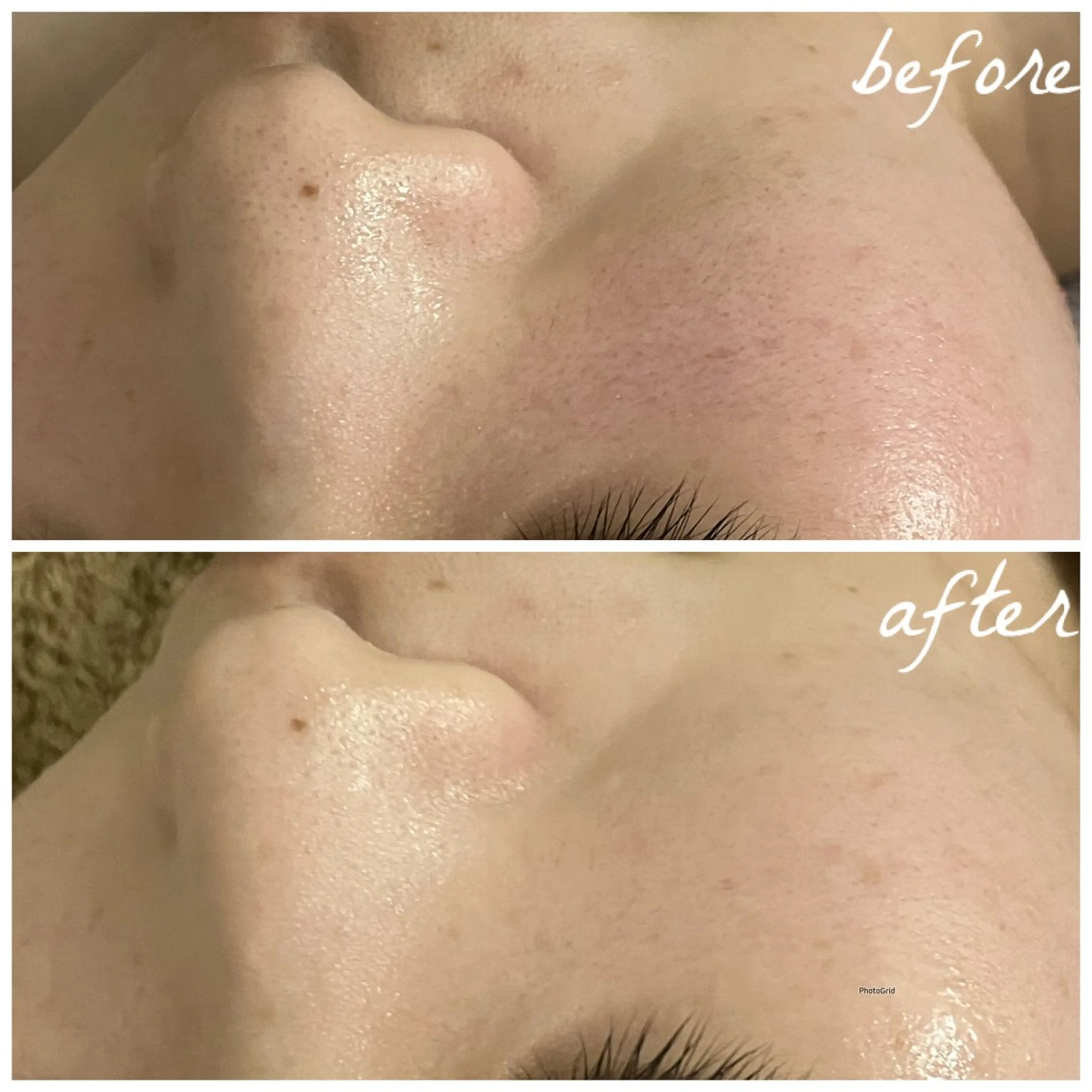 メンズ エステ メナード岐阜茜部 杉浦のエステ・リラクイメージ