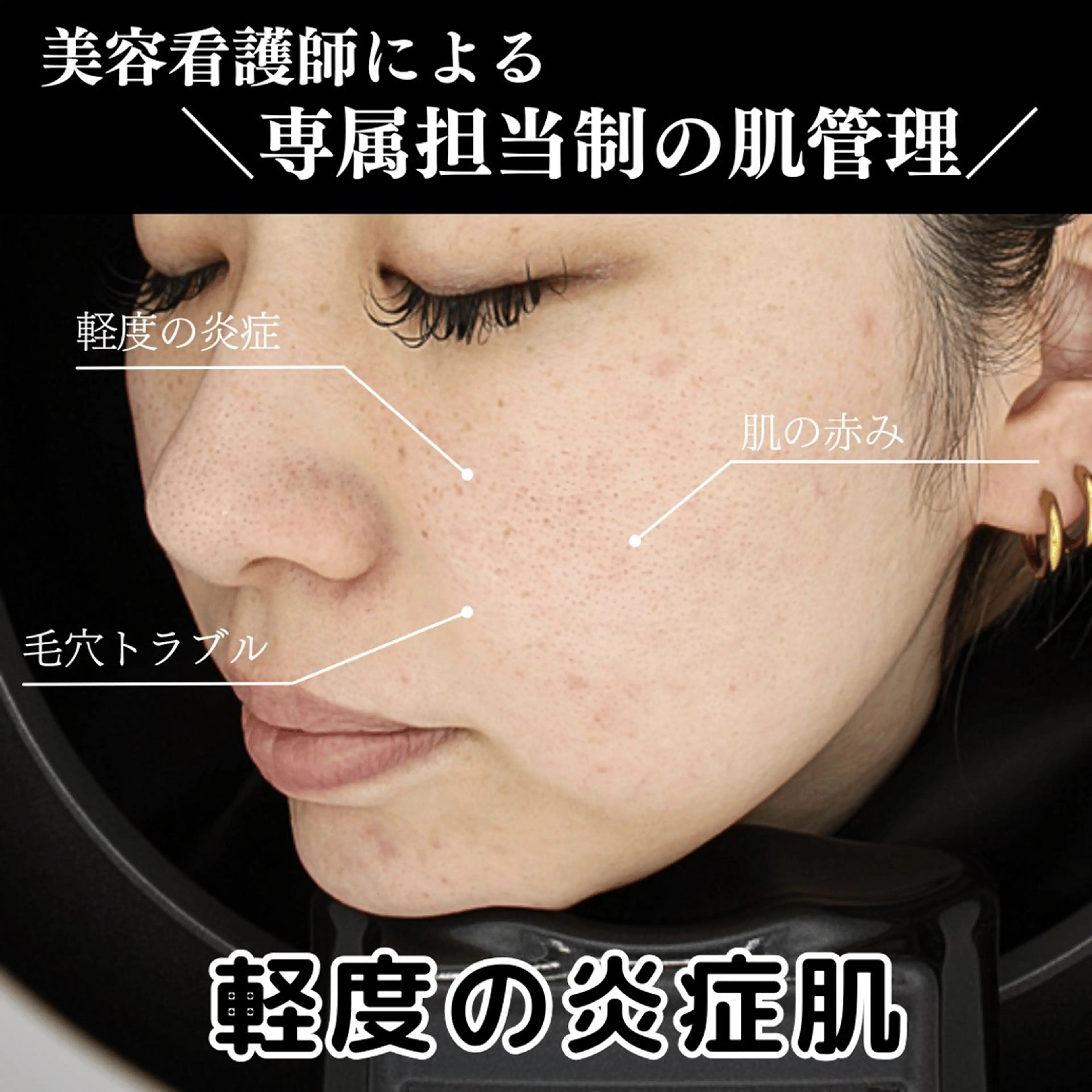 美容看護師専属担当制 医学に基づく肌管理のエステ・リラクイメージ