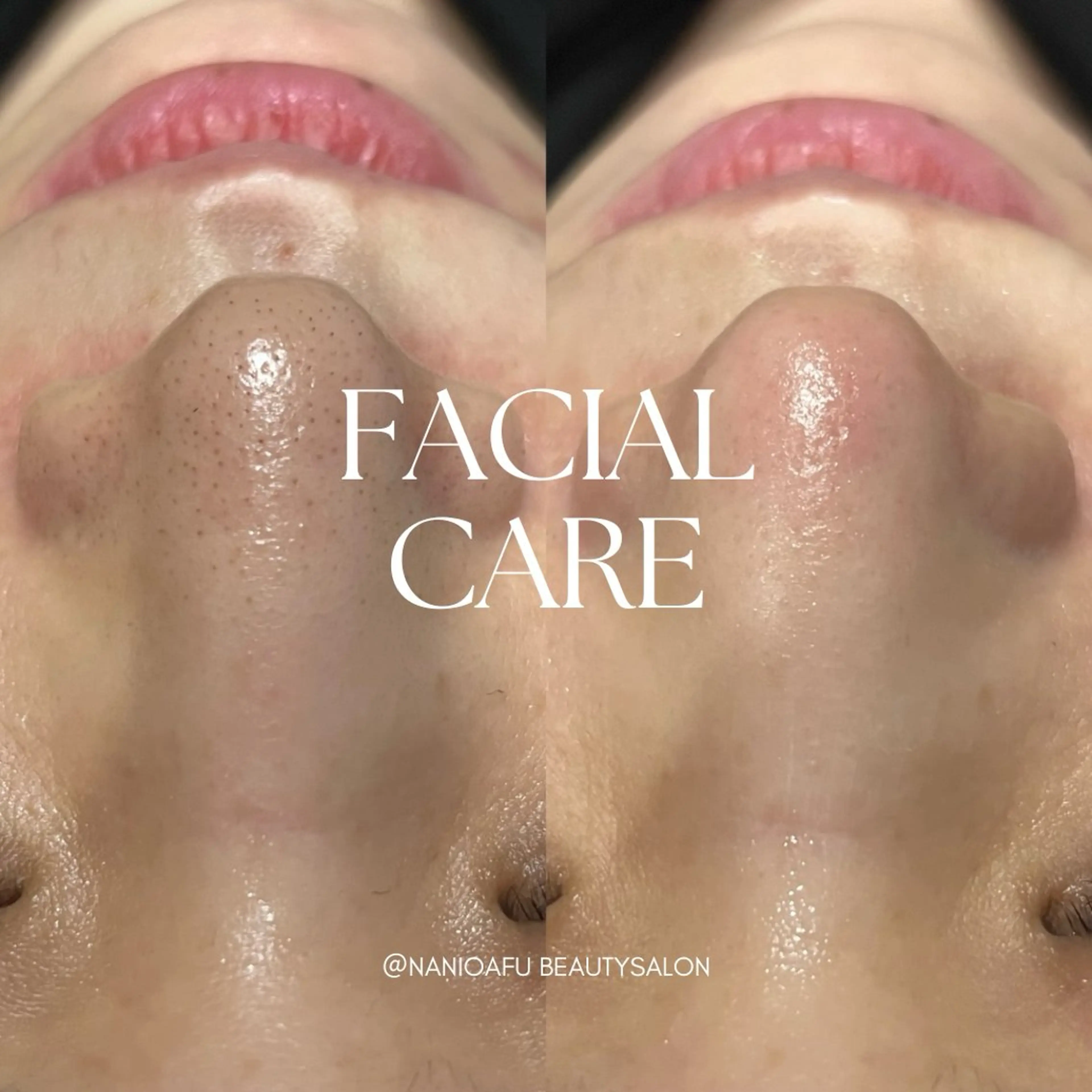 メンズ キッズ エステ リラク NANI OAFU所属・NANIOAFU [なんば店］のその他イメージ