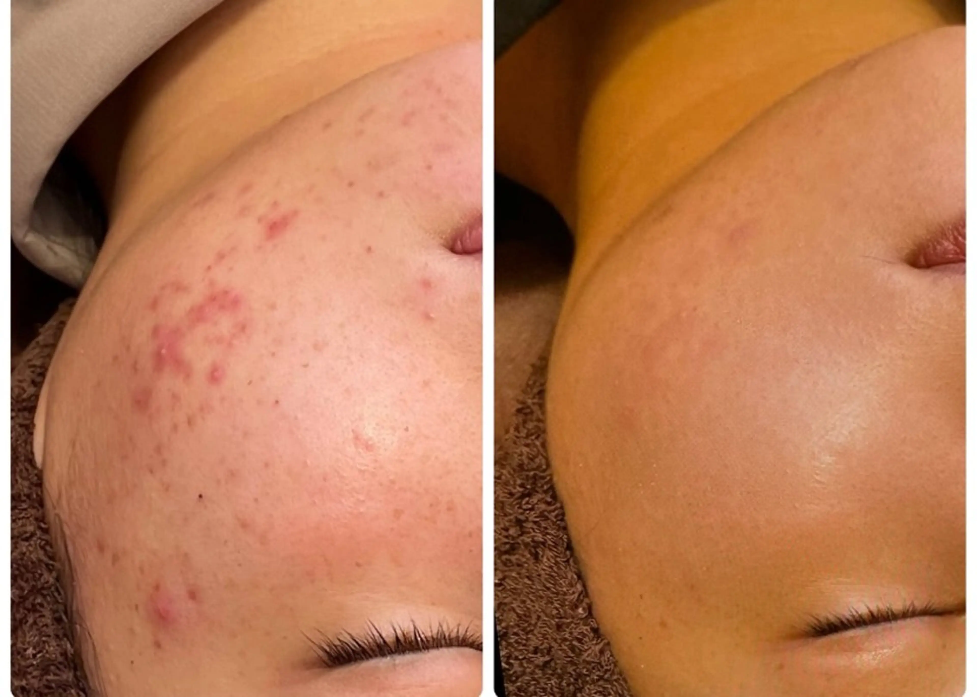 エステ 最速小顔・肌質管理 espoirマキのエステ・リラクイメージ