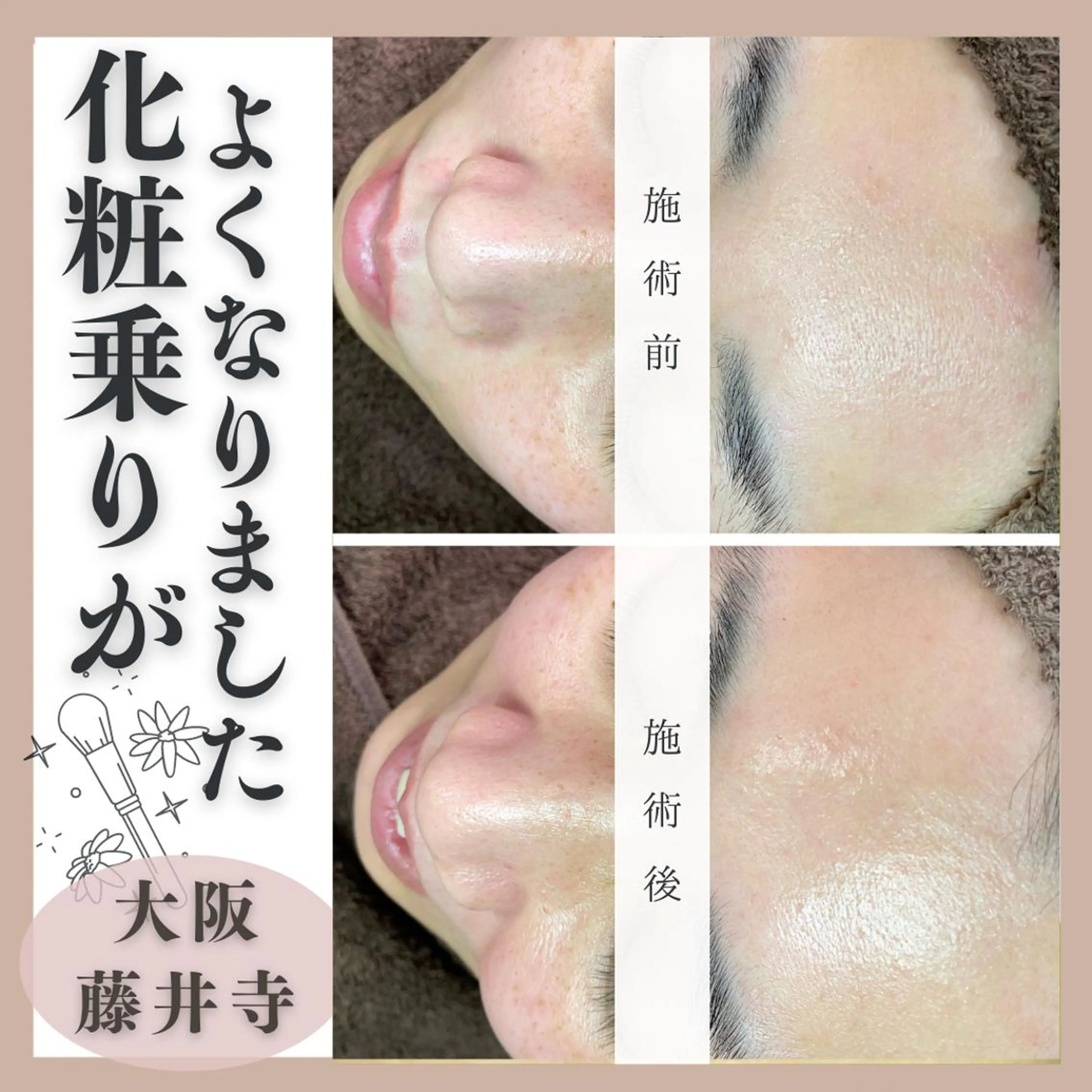 Muqu.所属・Muqu. 毛穴サロンのエステ・リラクイメージ