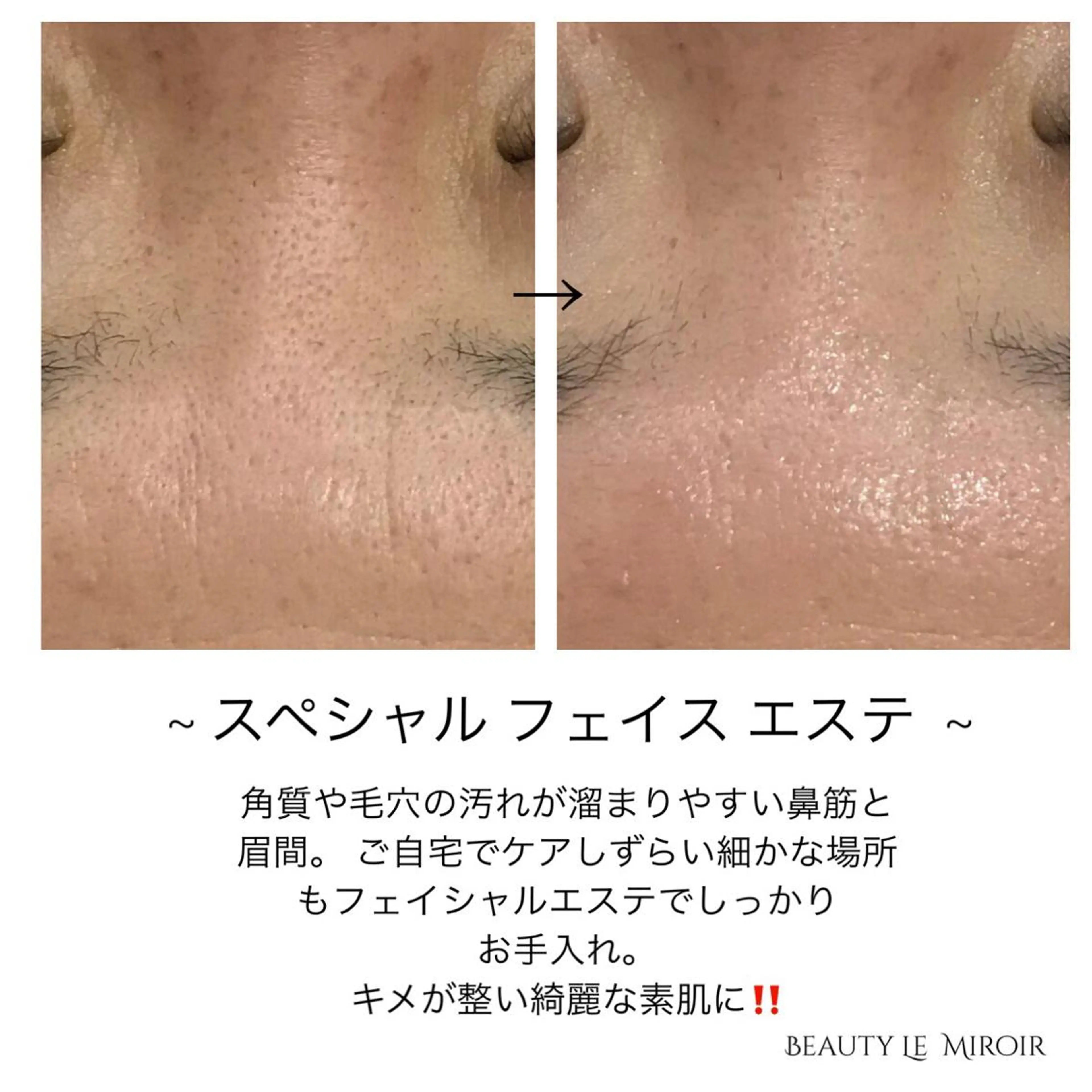 ビューティー ミロワールのエステ・リラクイメージ