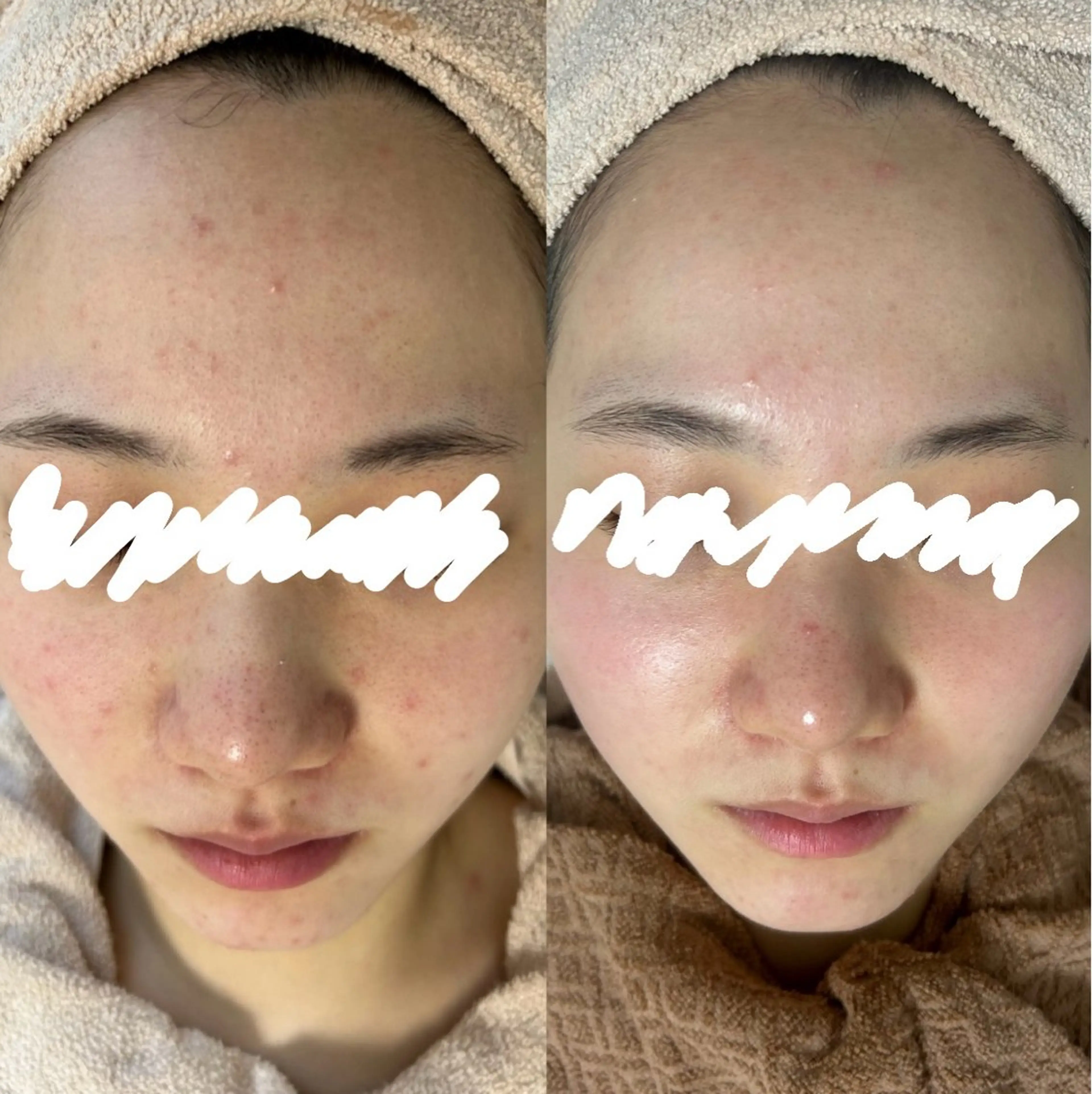 都度払い肌改善専門店 店長二上文香のエステ・リラクイメージ