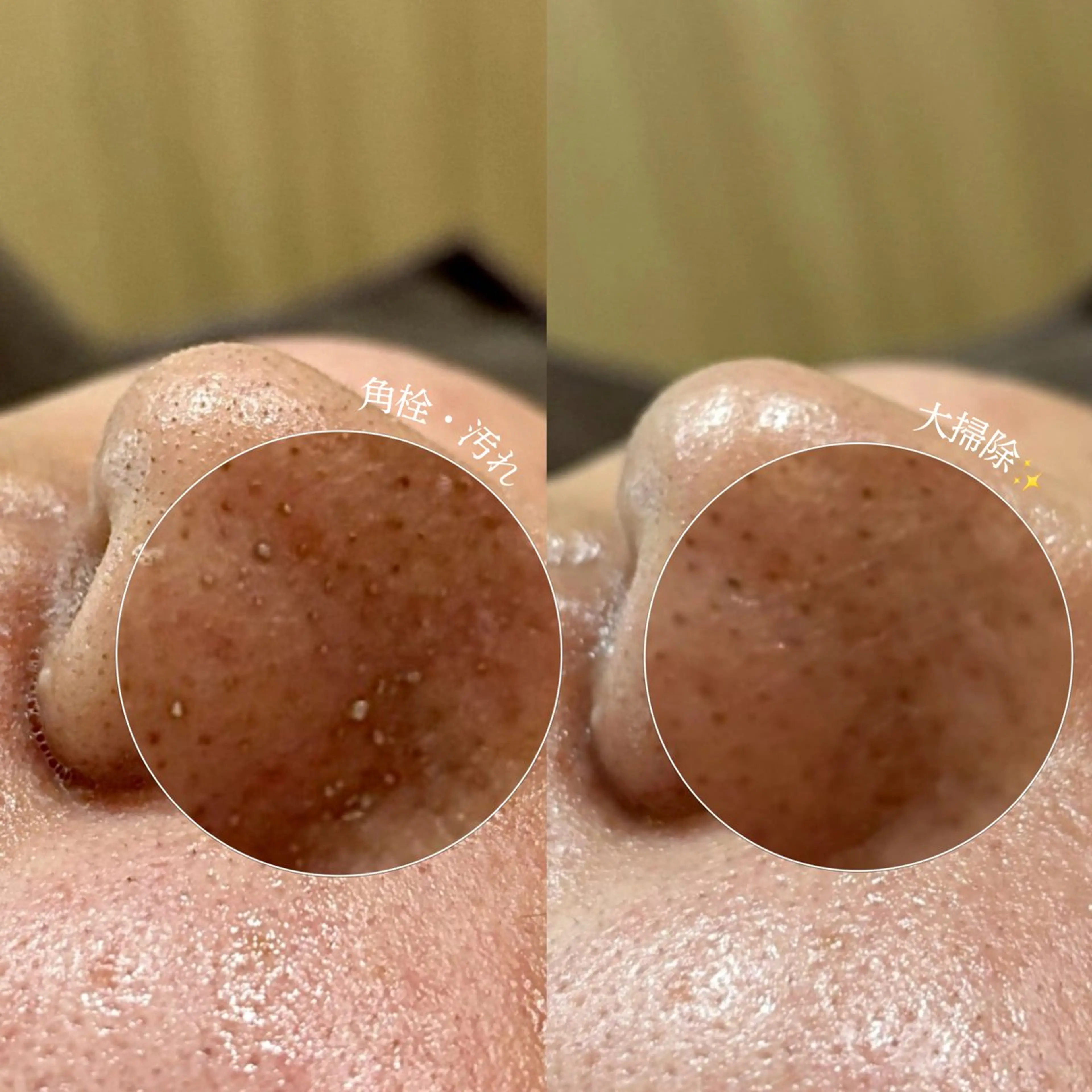 メンズ エステ Suu.今池/千種 メンズ眉毛の眉毛・アイブロウイメージ