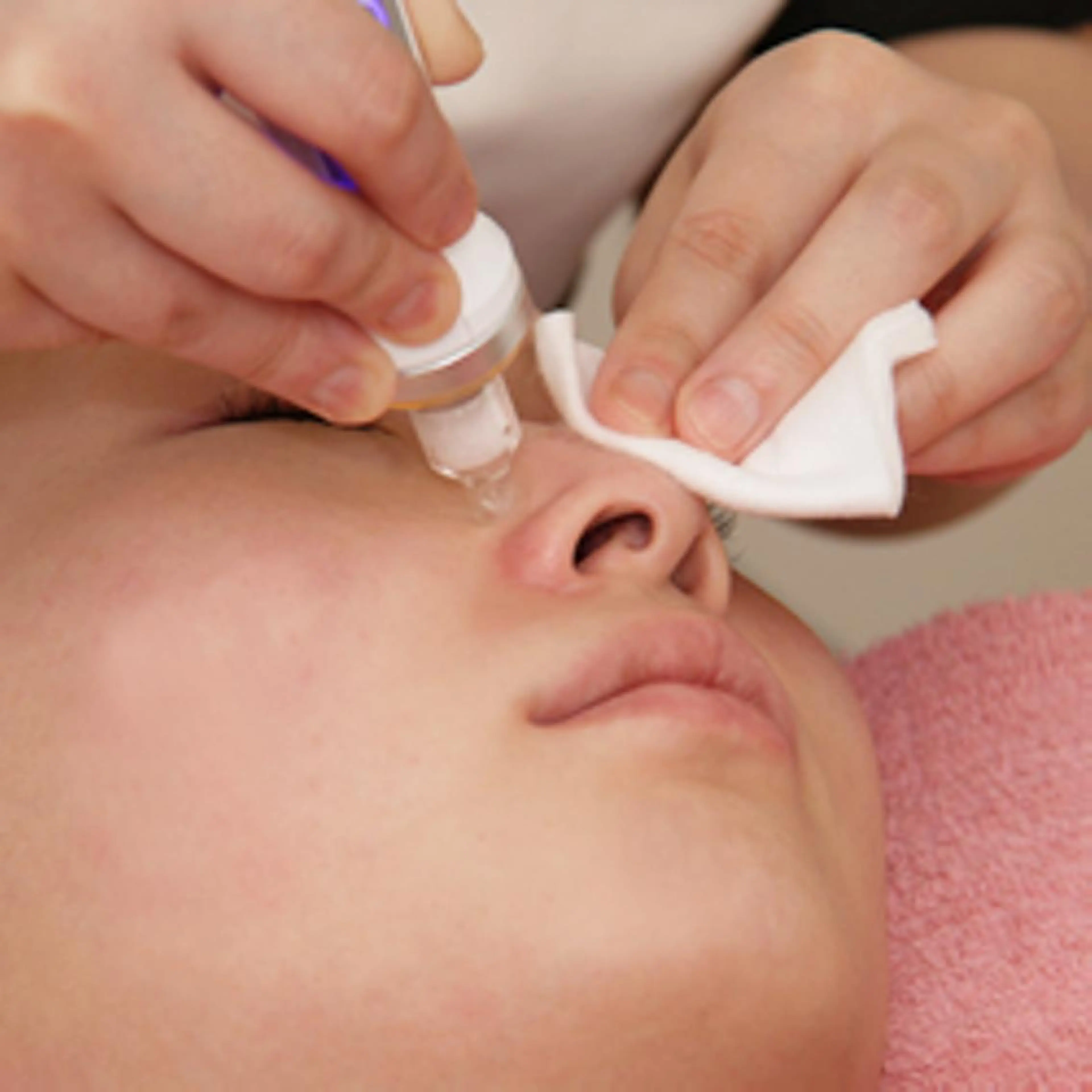 NEW！毛穴レス艶肌小顔コースの写真